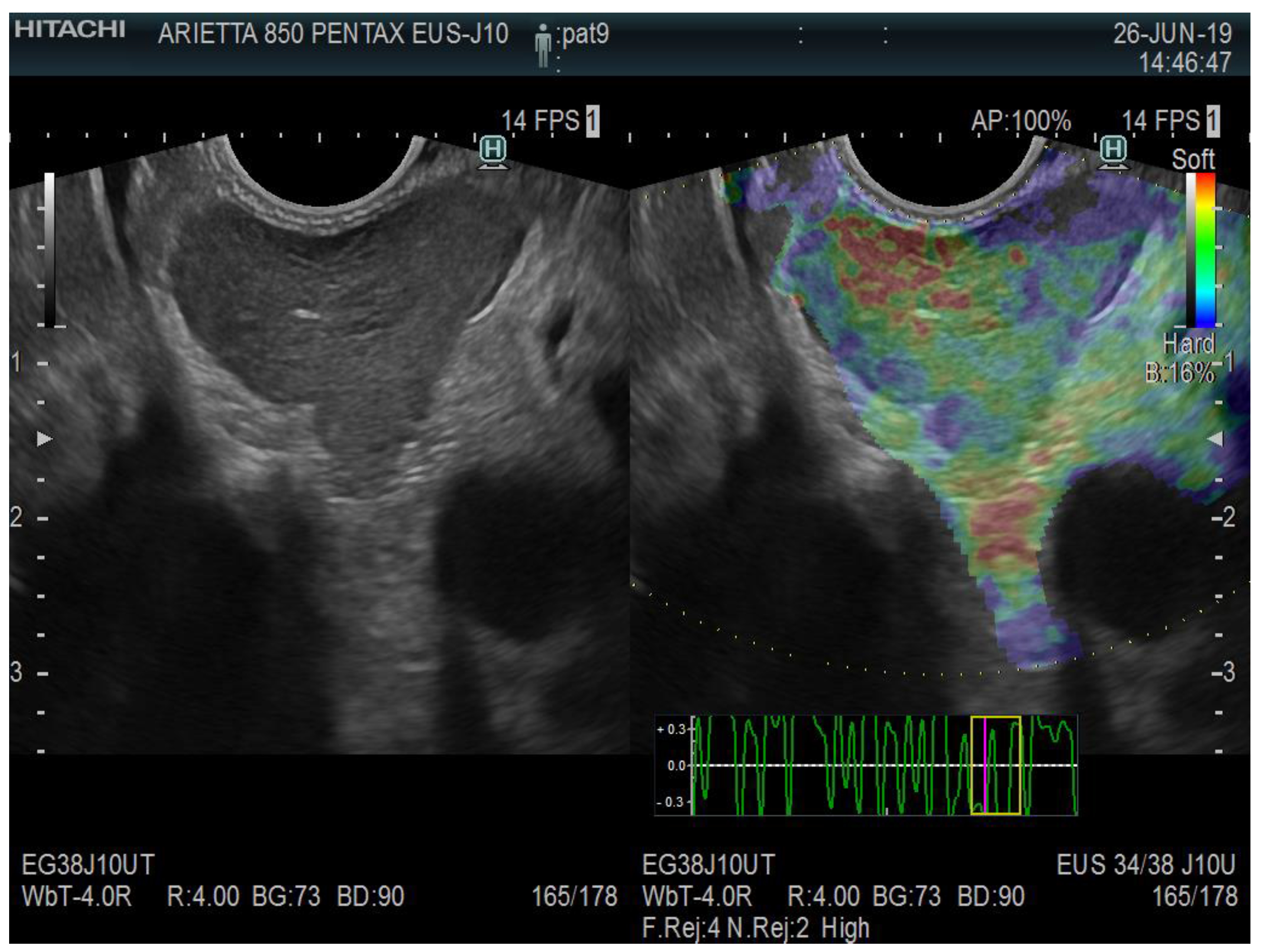 Diagnostics 13 01686 g008