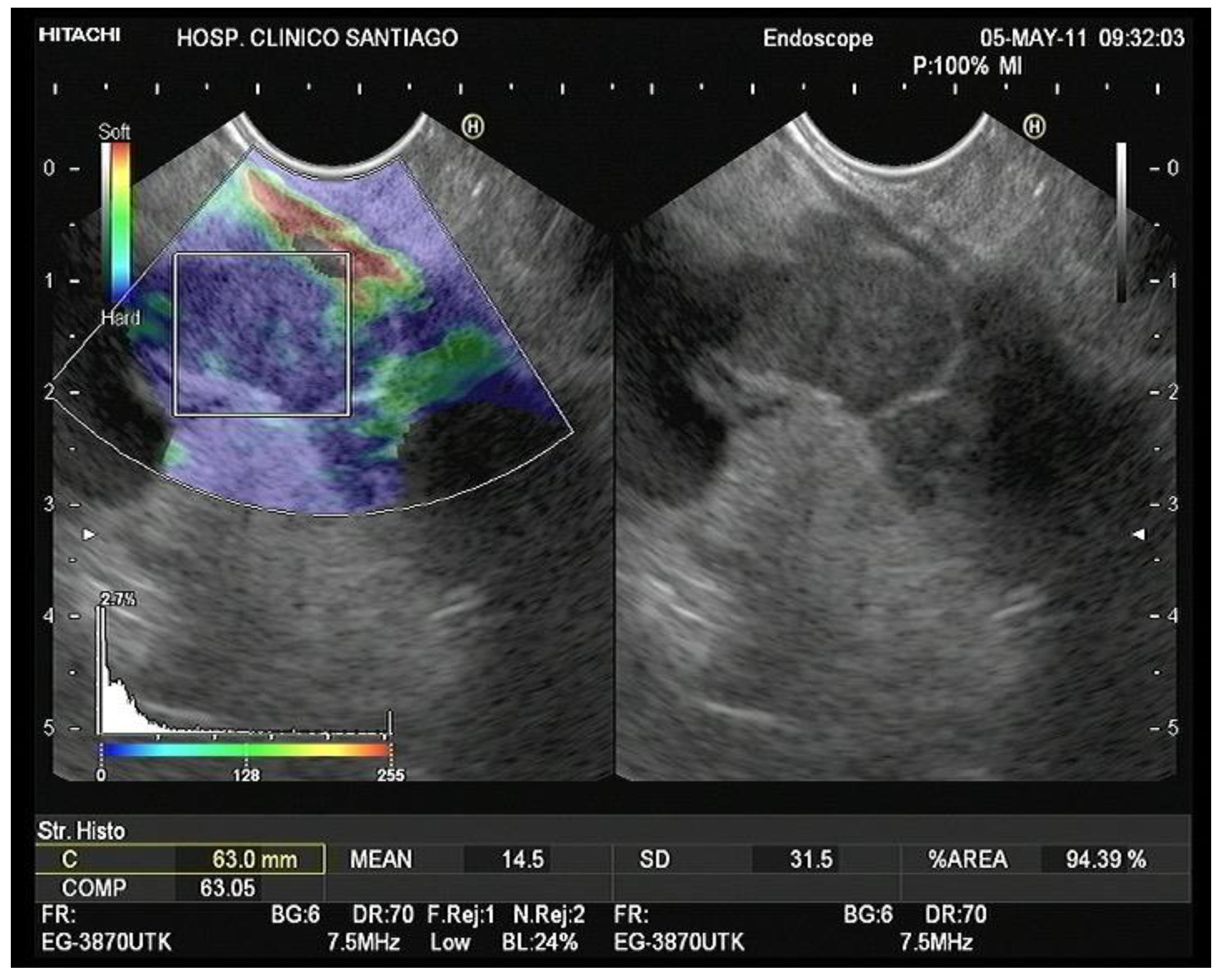 Diagnostics 13 01686 g009