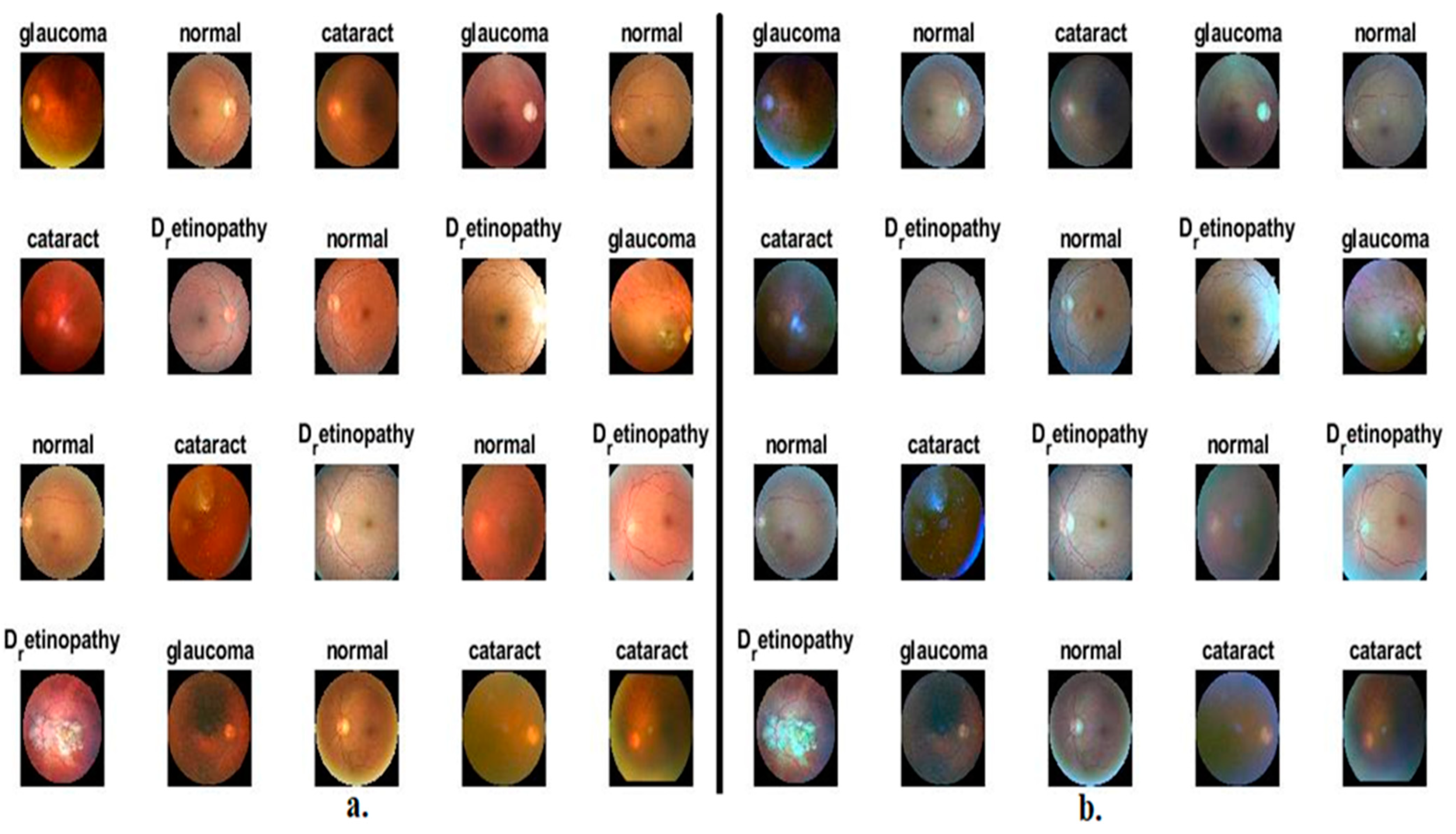 Diagnostics 13 01706 g002