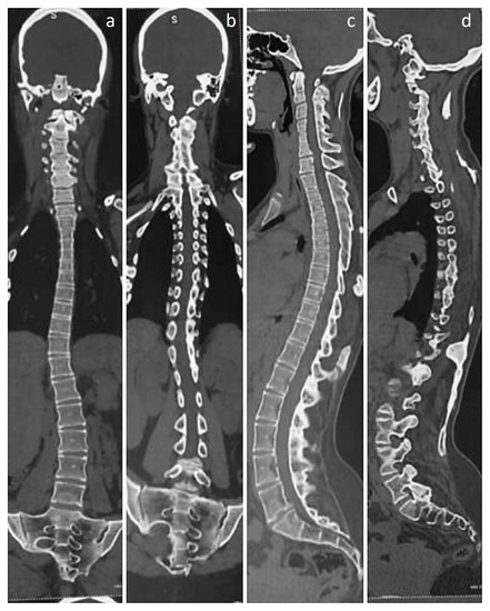 Diagnostics 13 01711 g002