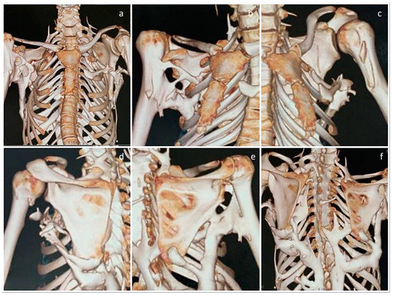 Diagnostics 13 01711 g003