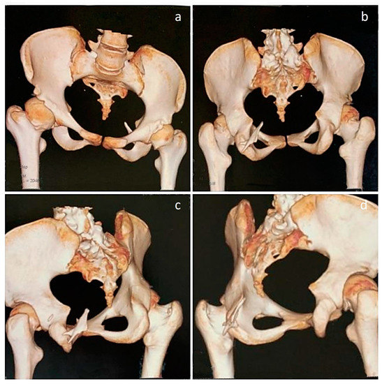 Diagnostics 13 01711 g004