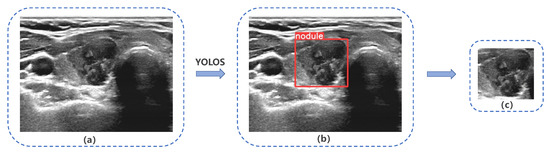Diagnostics 13 01723 g005