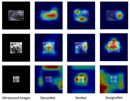 Diagnostics 13 01723 g007