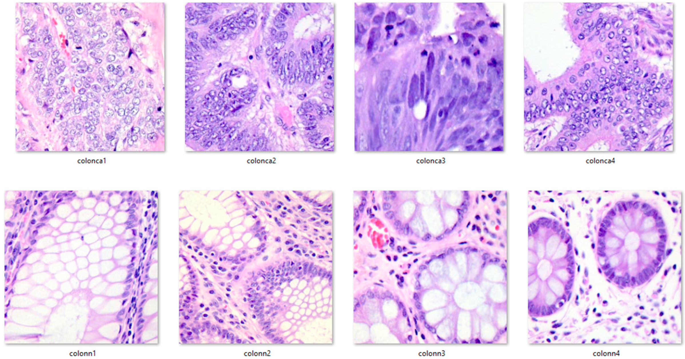 Diagnostics 13 01728 g006