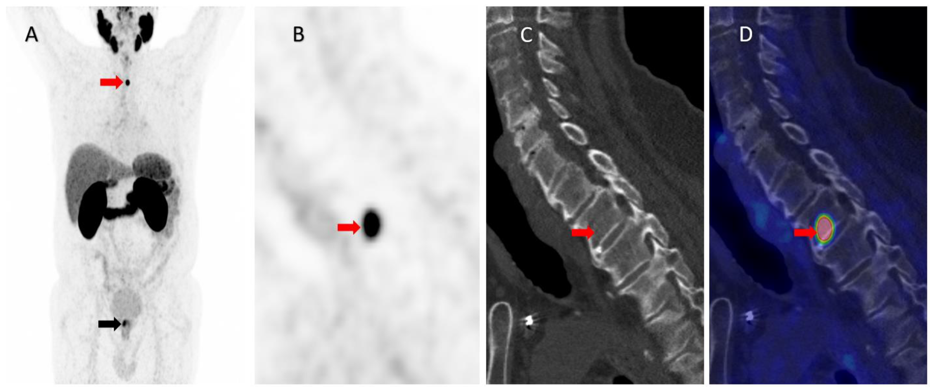 Diagnostics 13 01730 g001