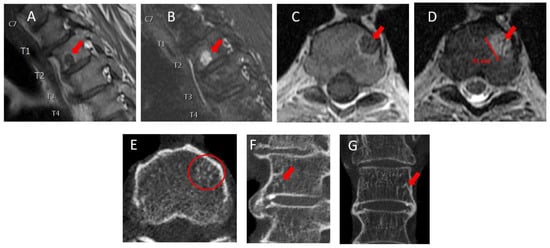 Diagnostics 13 01730 g002