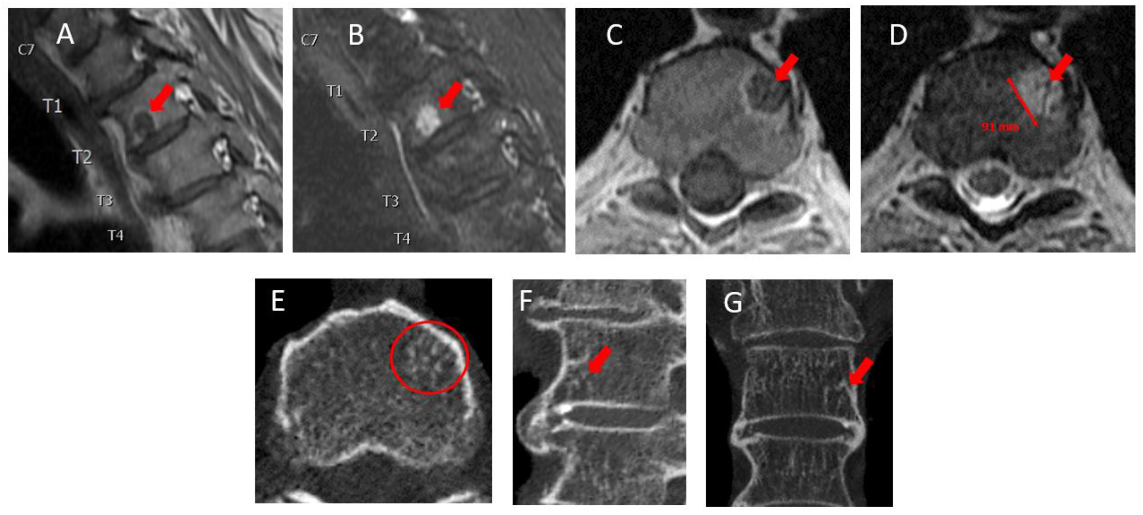 Diagnostics 13 01730 g002