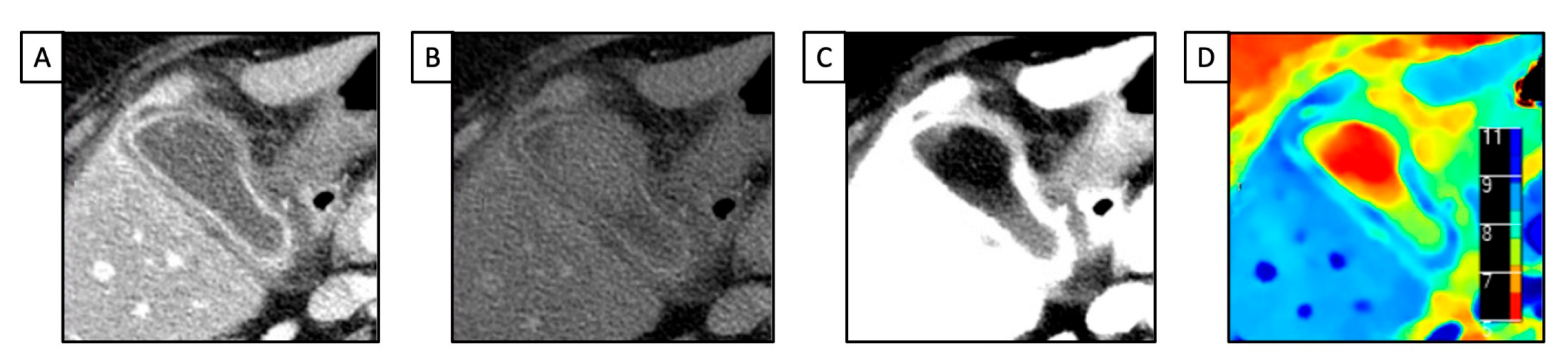 Diagnostics 13 01740 g002