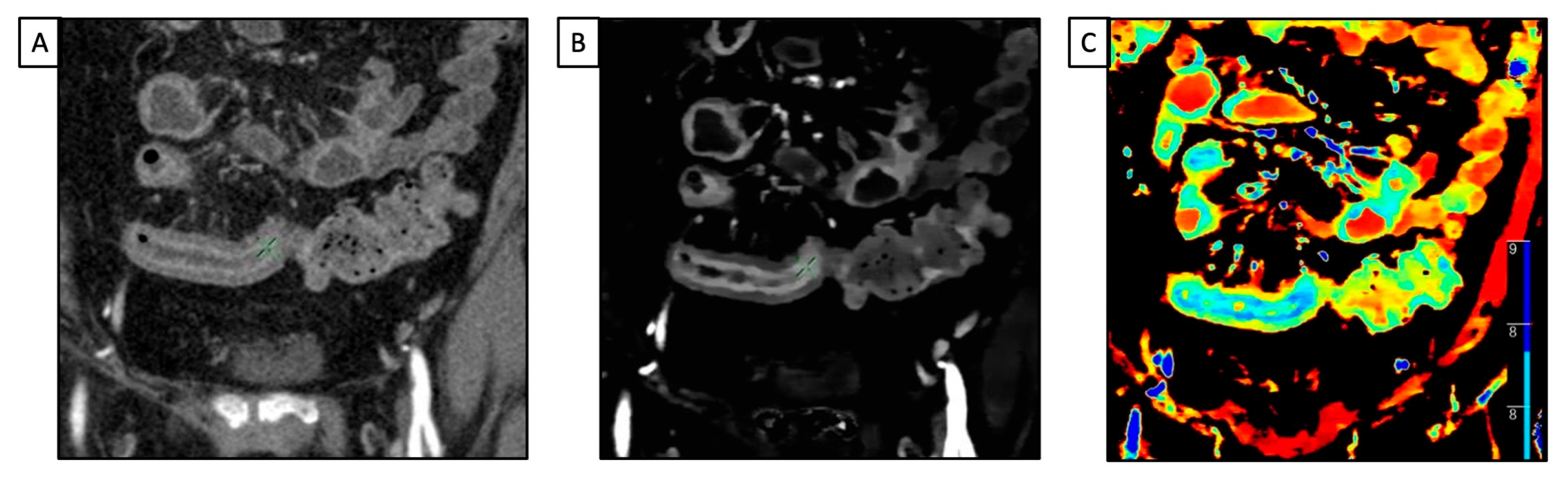 Diagnostics 13 01740 g003