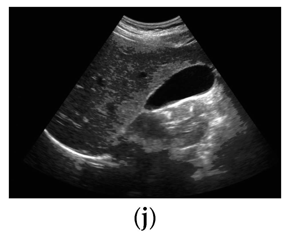 Diagnostics 13 01744 g001b