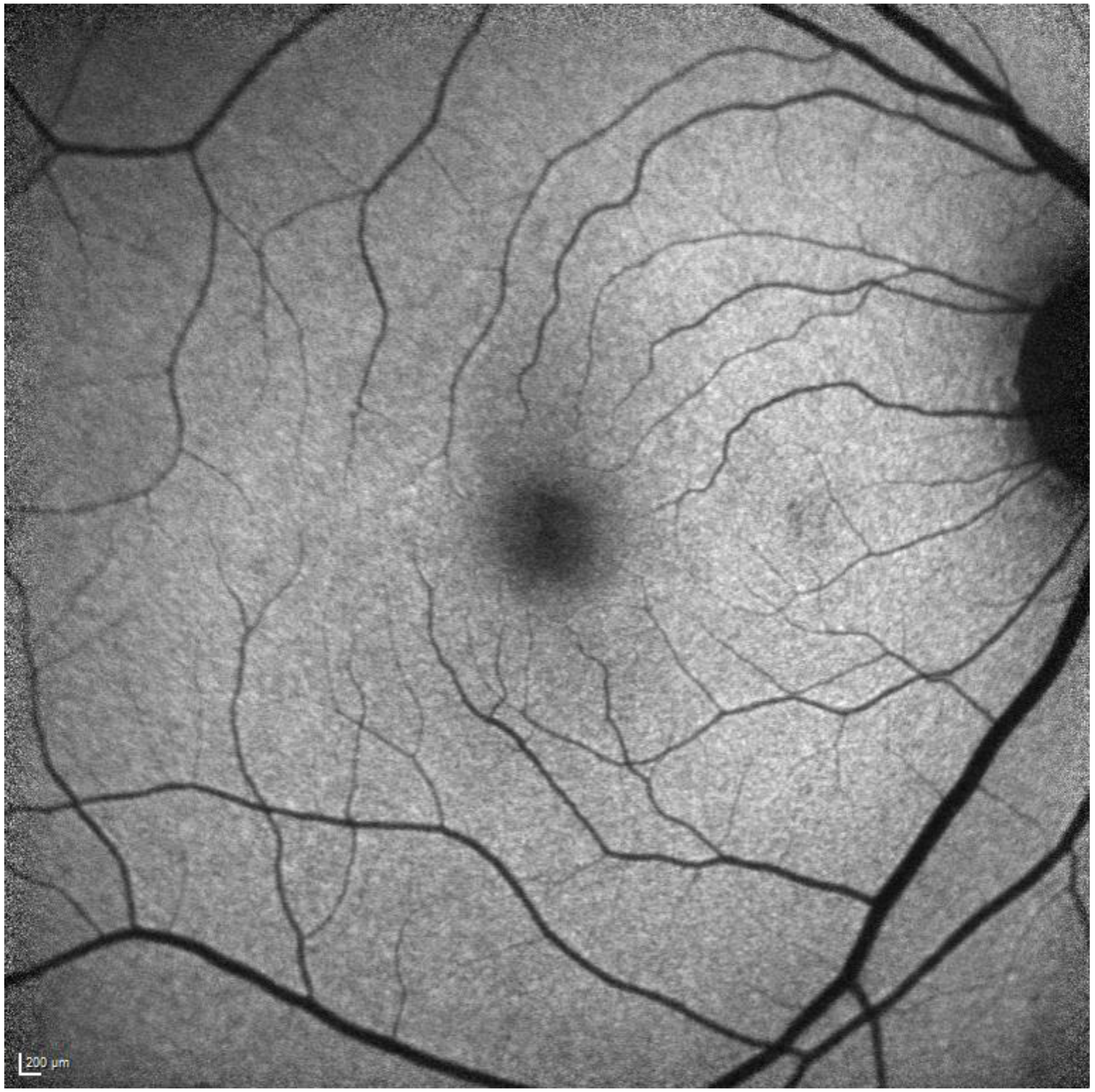 Diagnostics 13 01752 g002