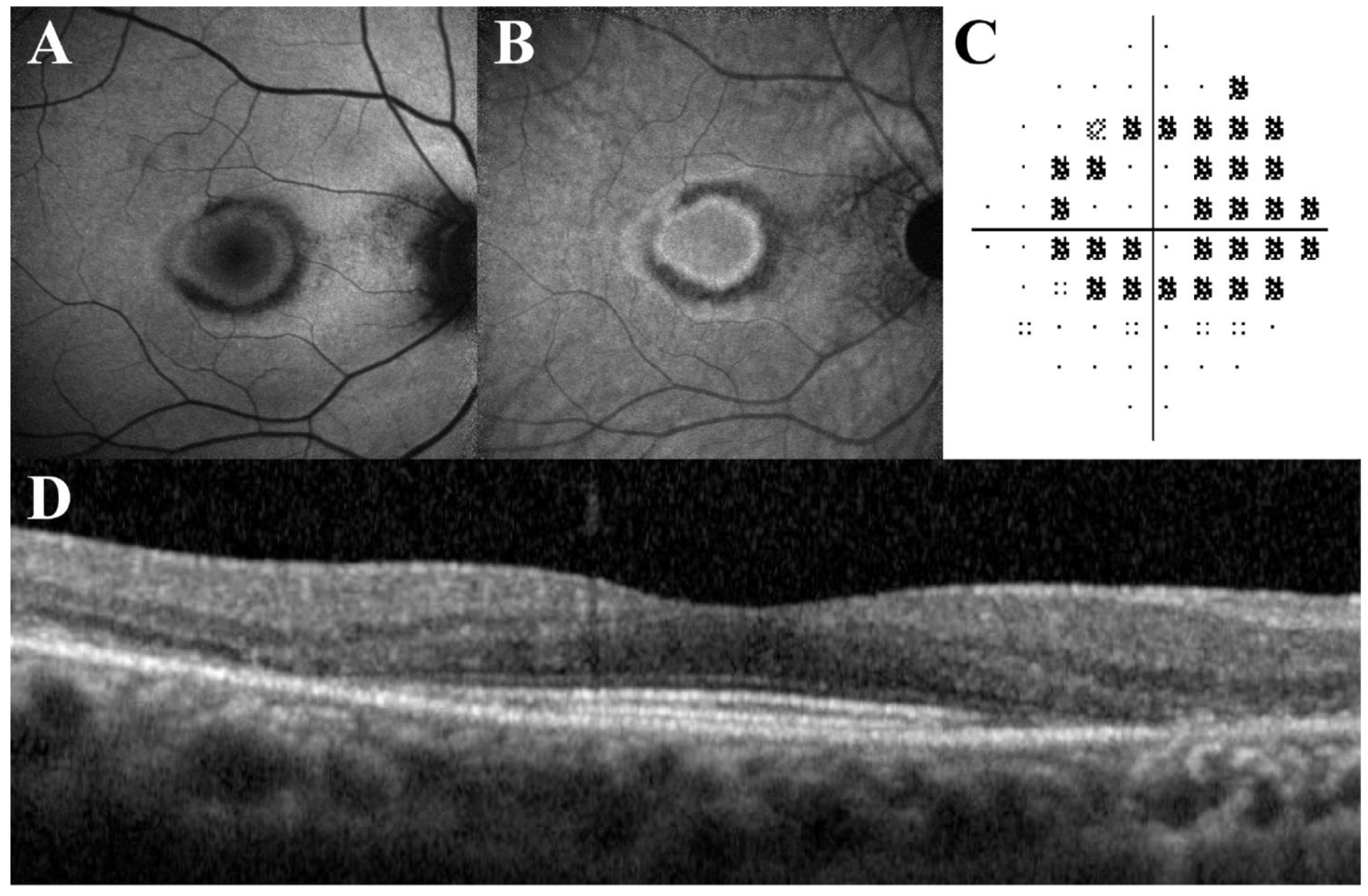 Diagnostics 13 01752 g007