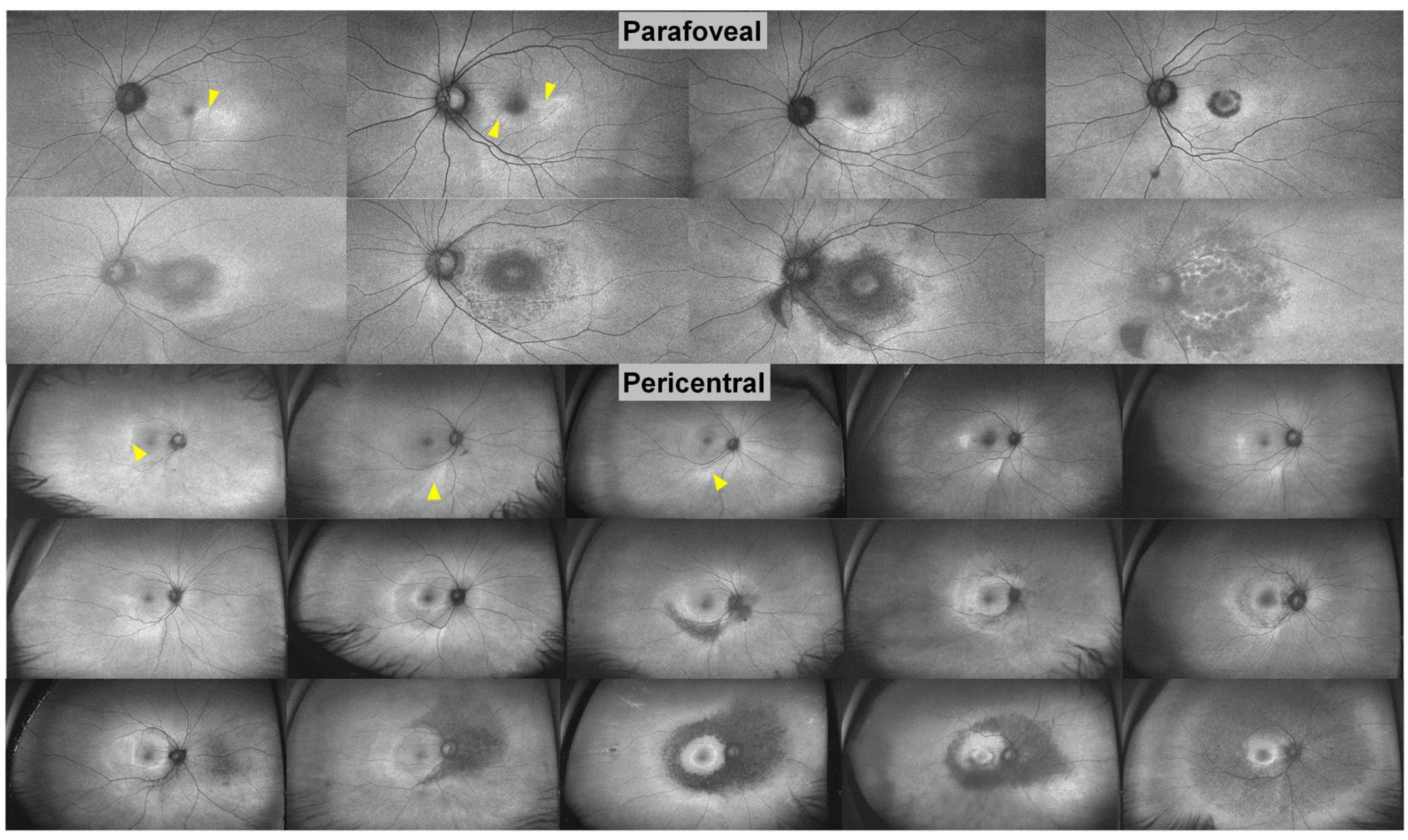 Diagnostics 13 01752 g008