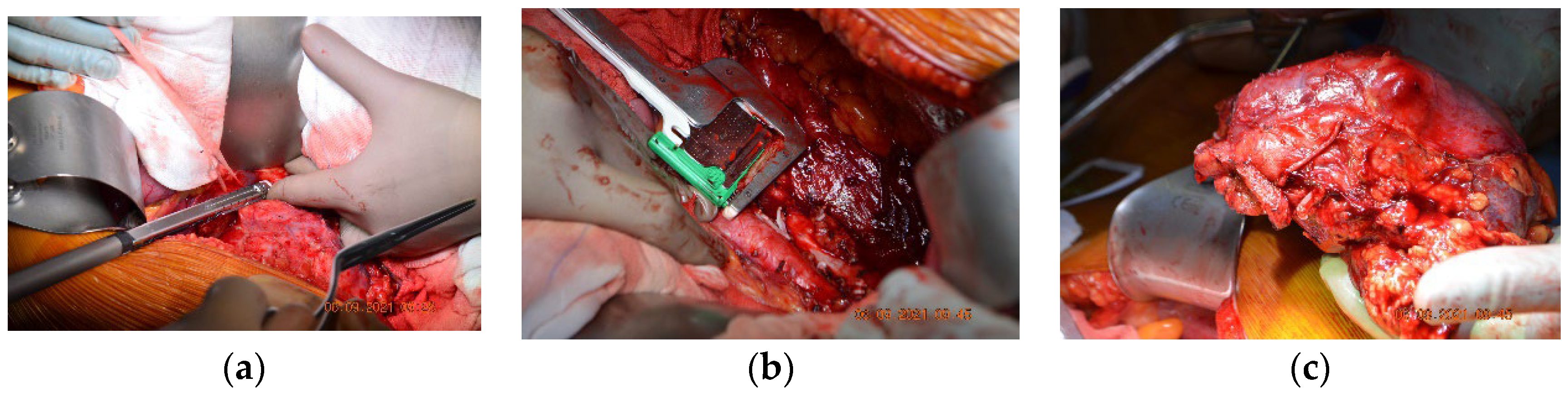 Diagnostics 13 01759 g002