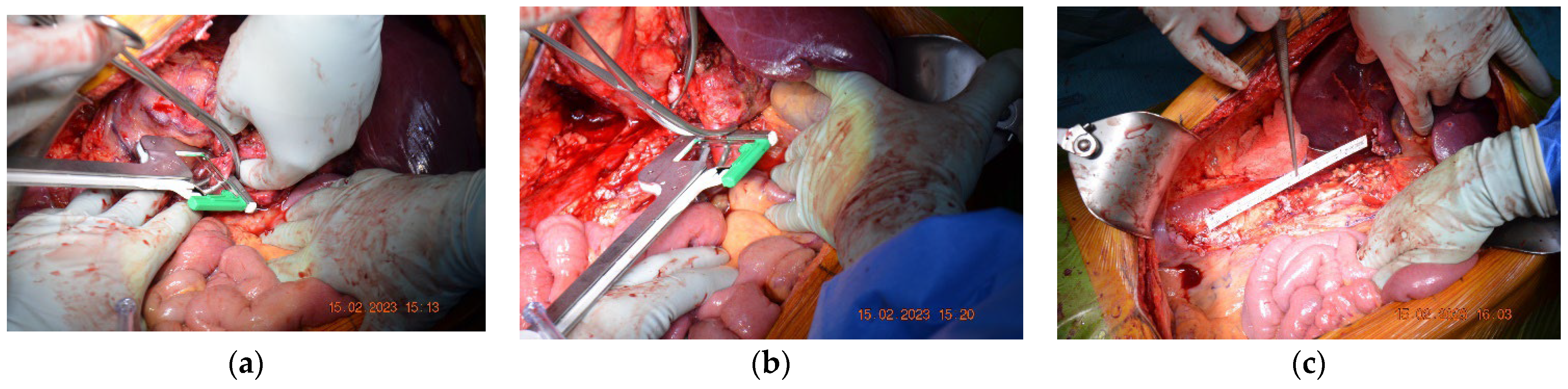 Diagnostics 13 01759 g005