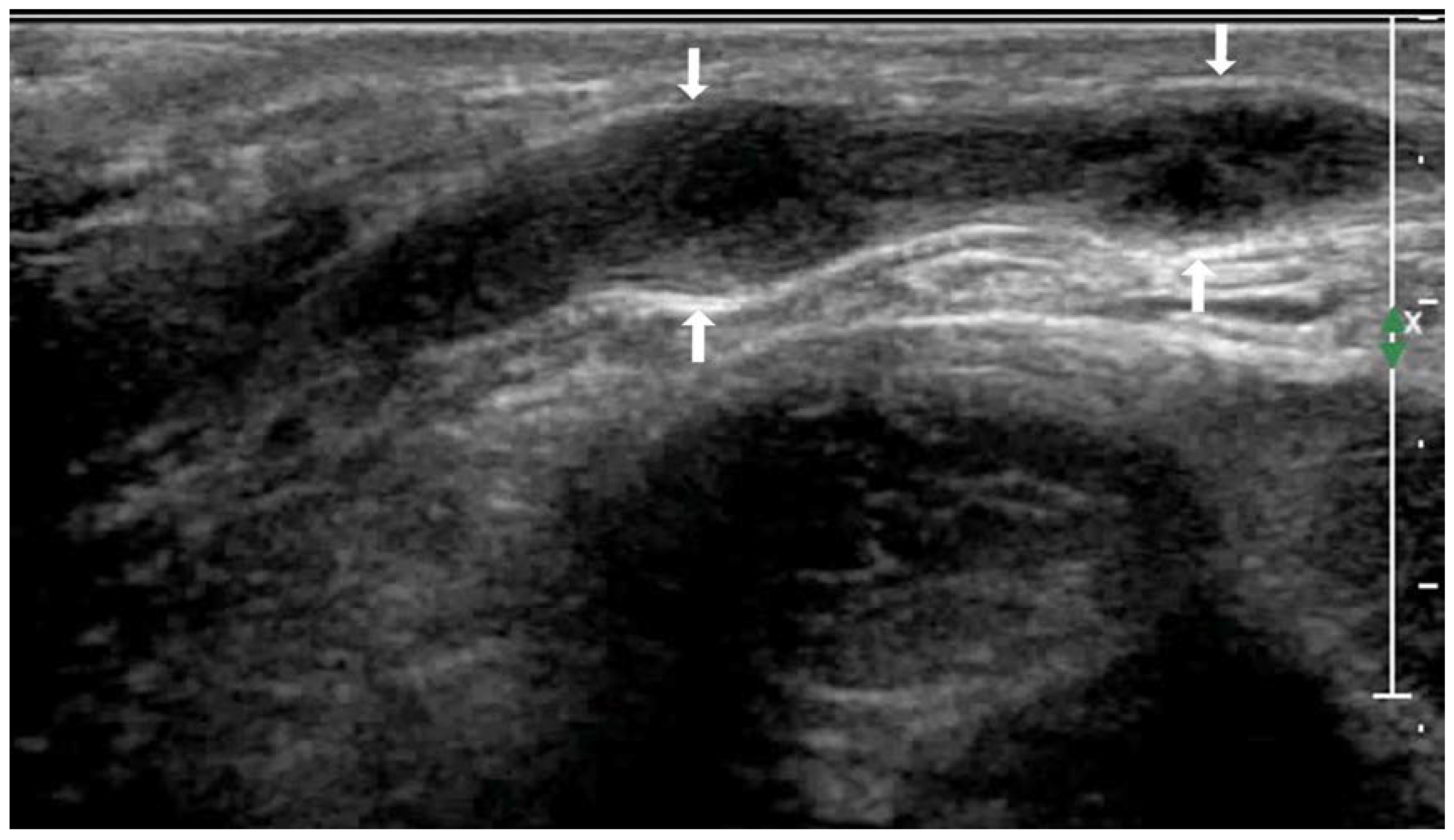 Diagnostics 13 01762 g001