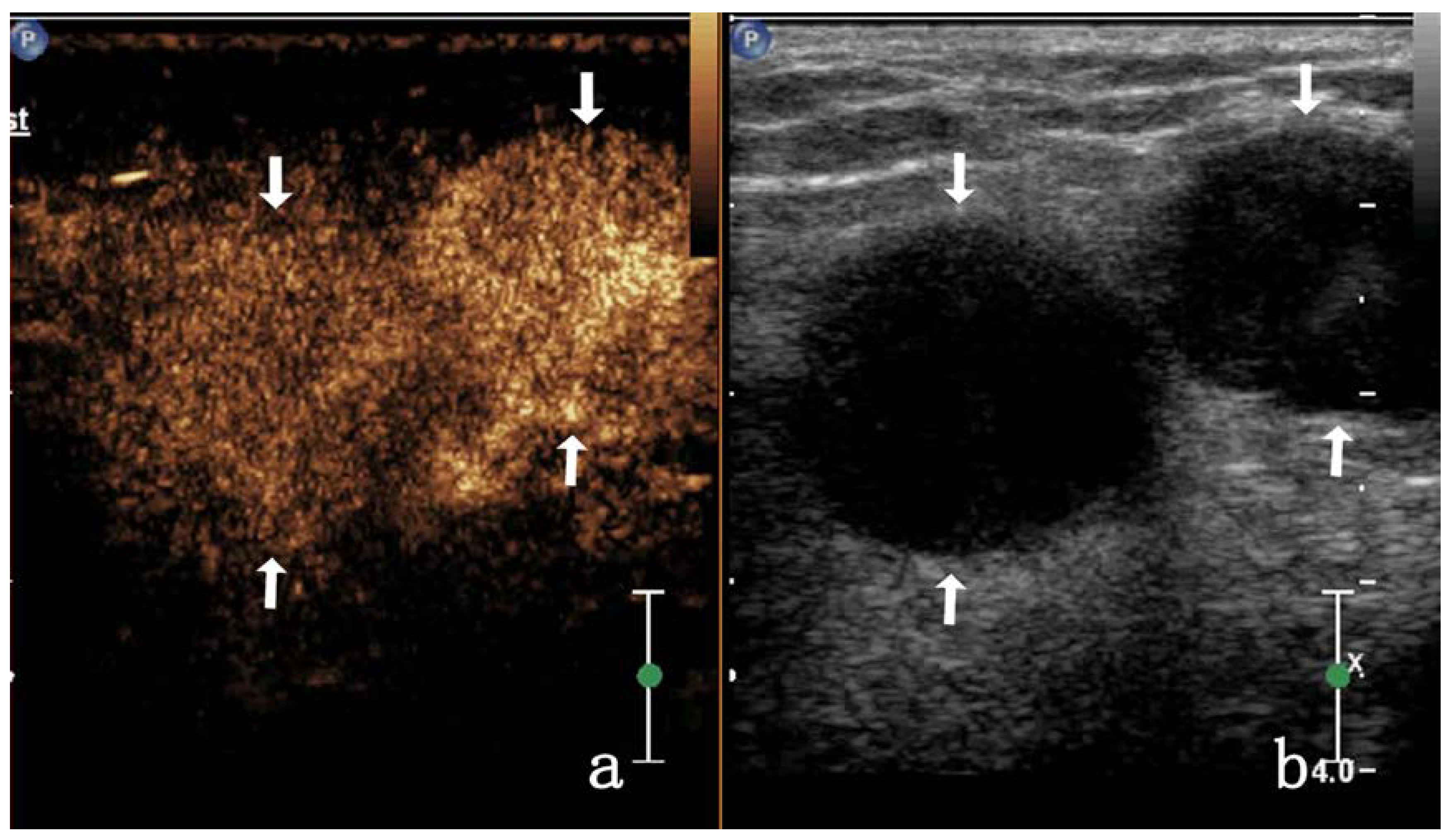 Diagnostics 13 01762 g005