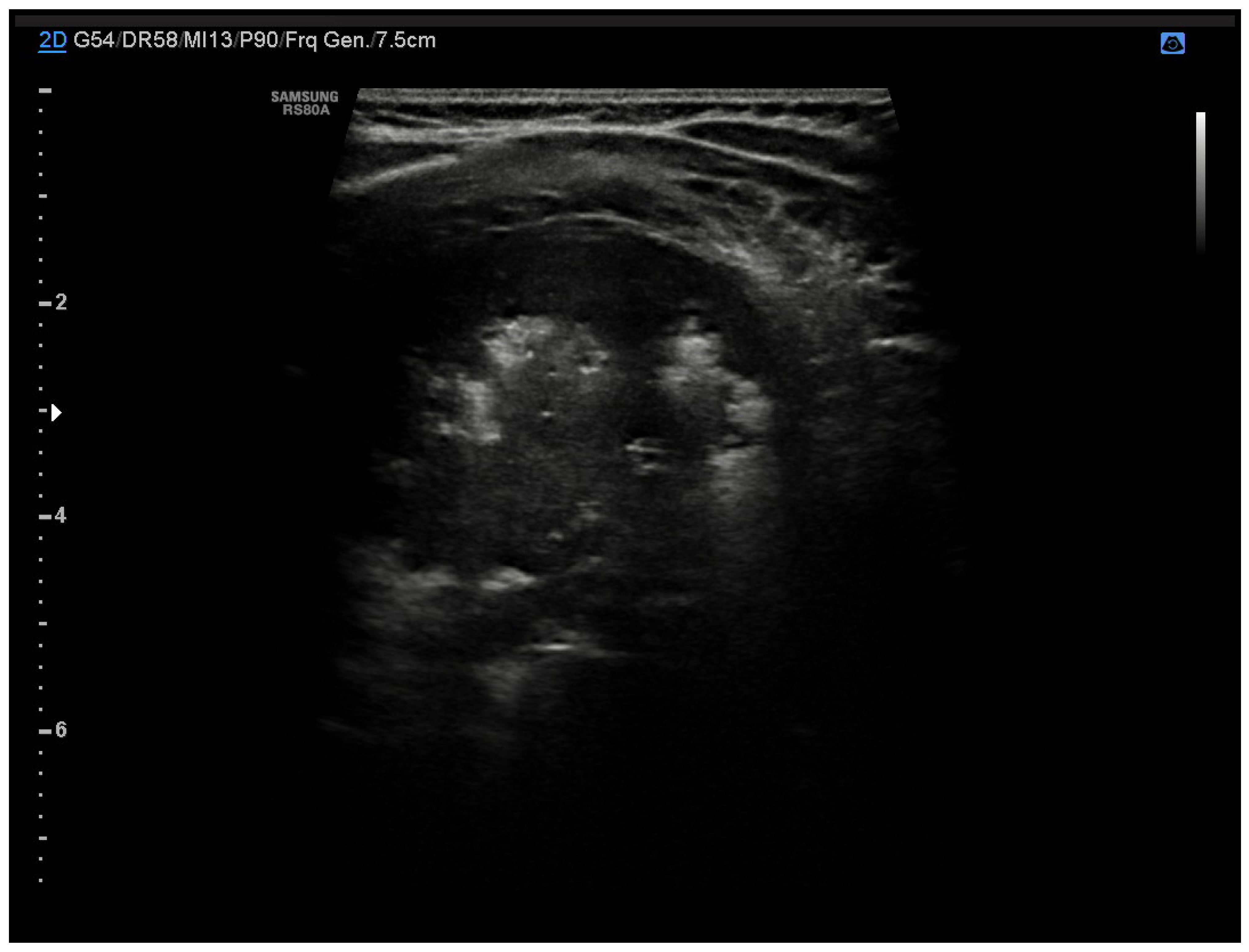 Diagnostics 13 01765 g003