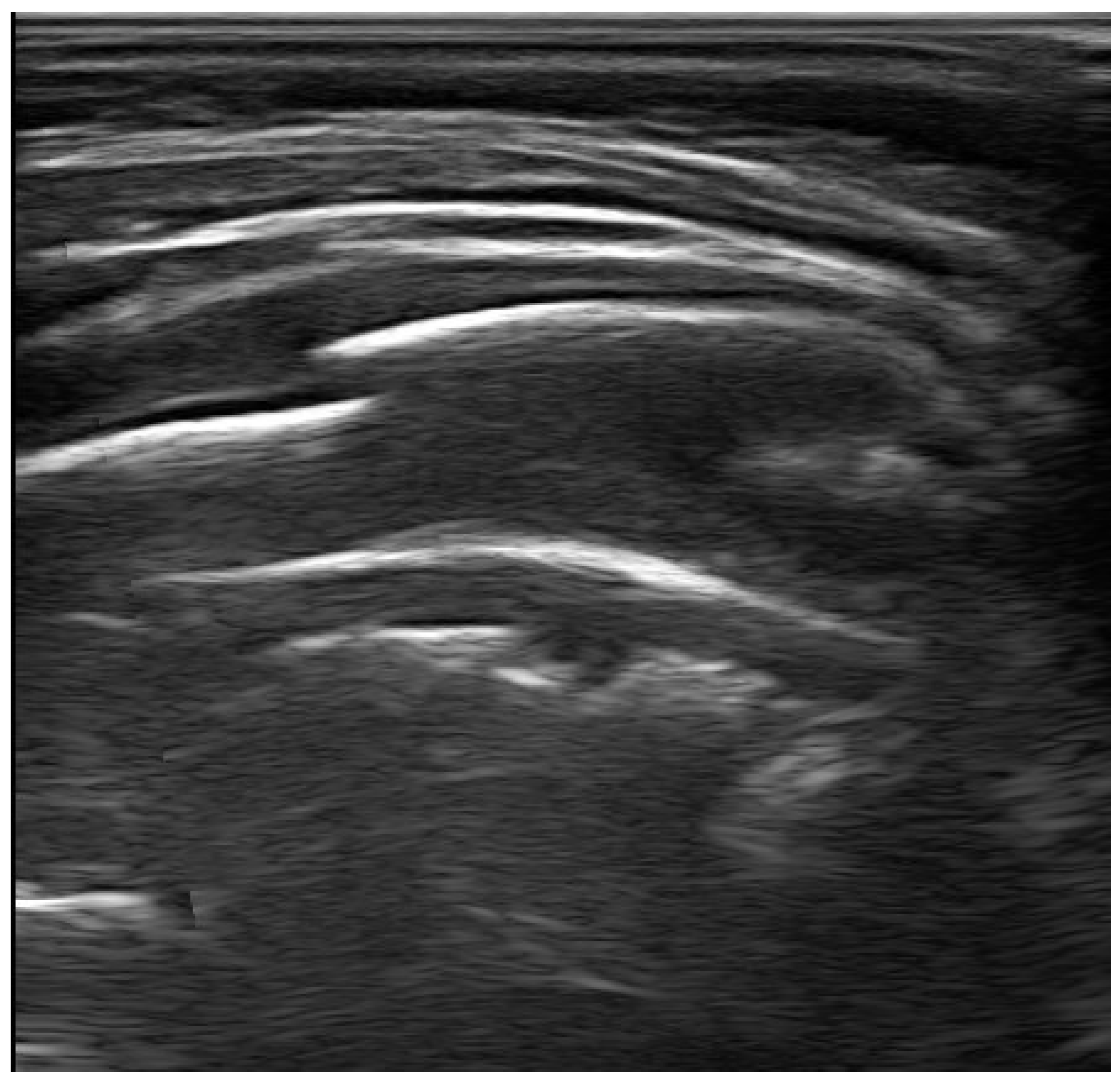 Diagnostics 13 01765 g006