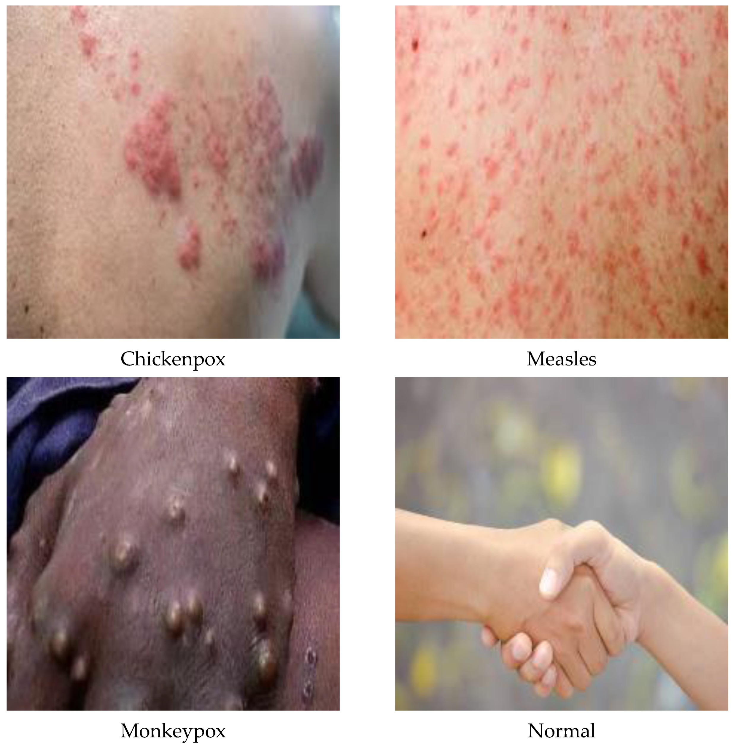 Diagnostics 13 01772 g003