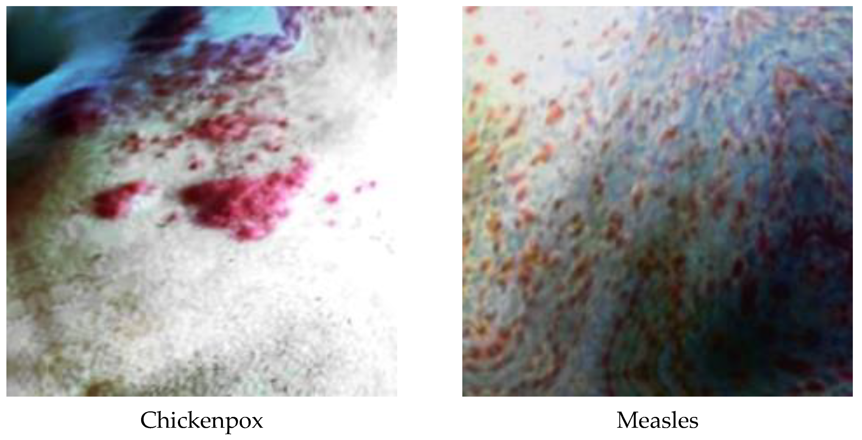 Diagnostics 13 01772 g004a