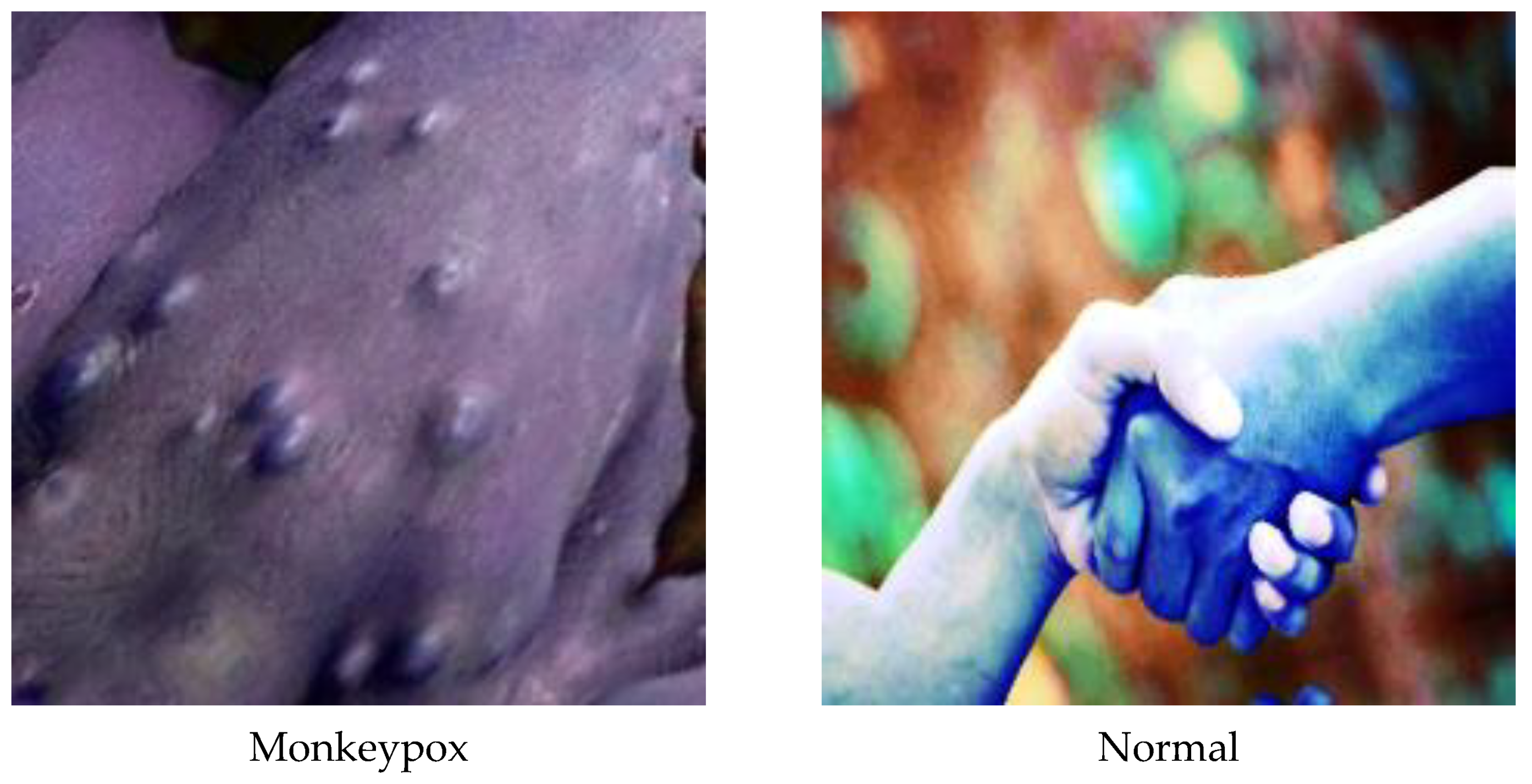 Diagnostics 13 01772 g004b