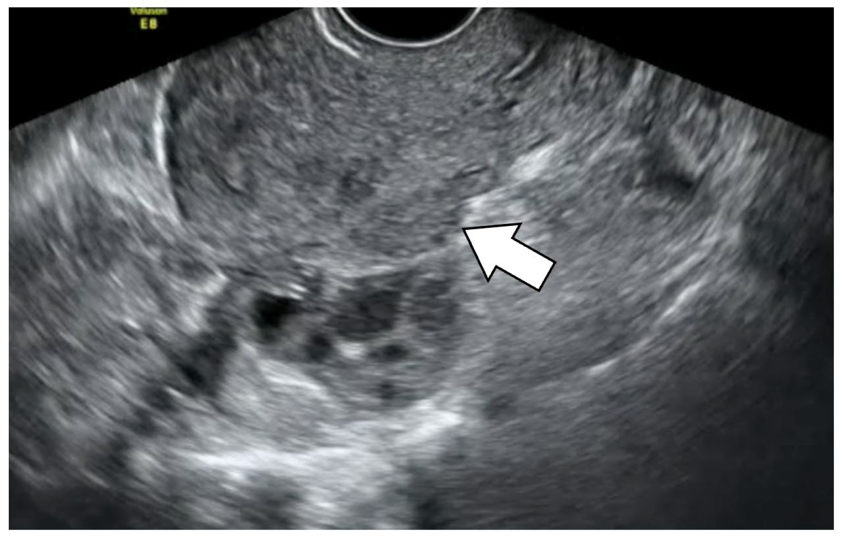 Diagnostics 13 01774 g003