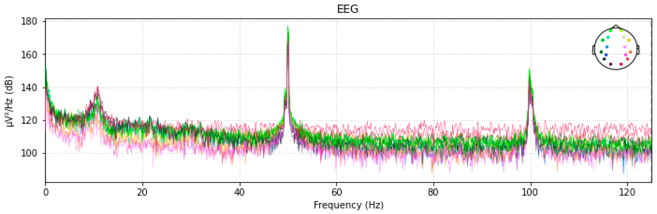 Diagnostics 13 01779 g005 Diagnostics 13 01779 g005