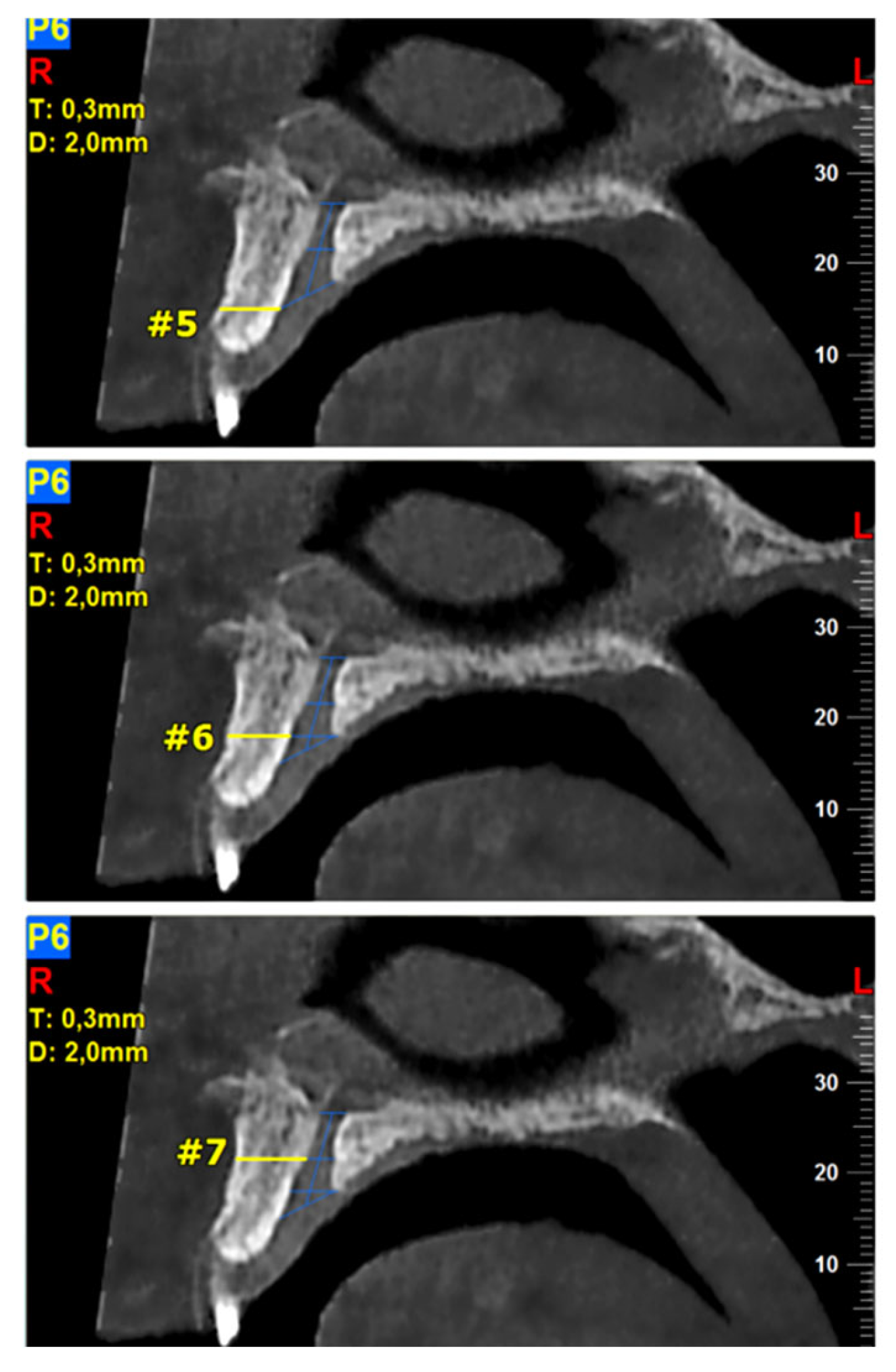 Diagnostics 13 01787 g002 Diagnostics 13 01787 g002