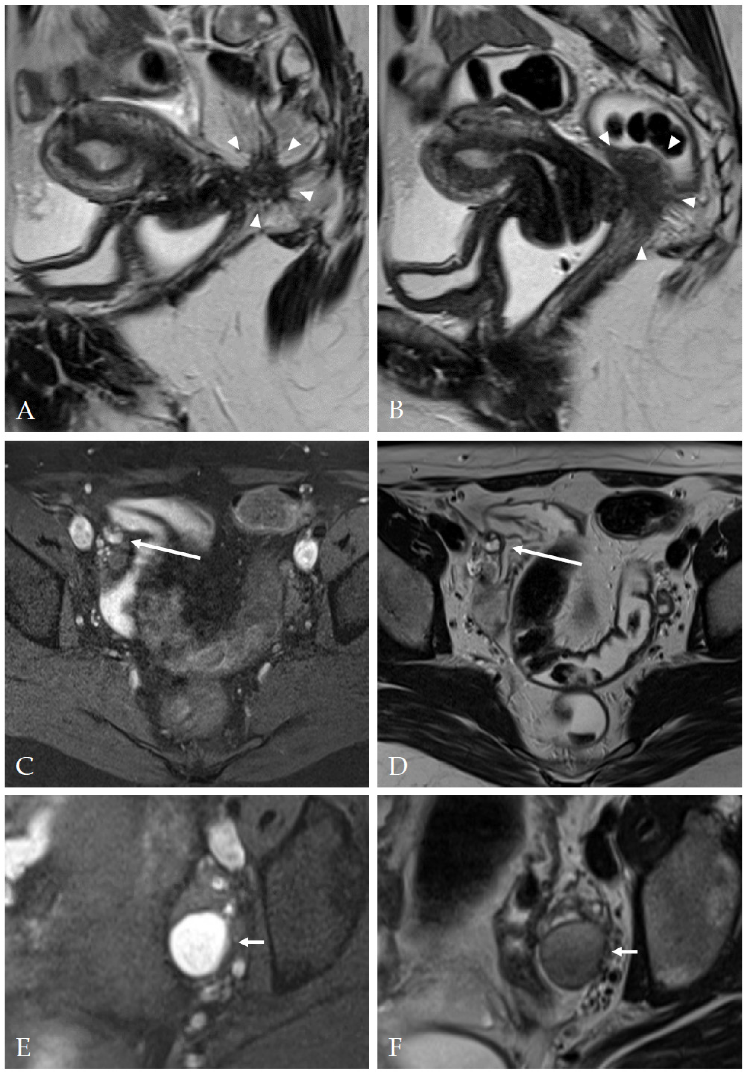 Diagnostics 13 01794 g004