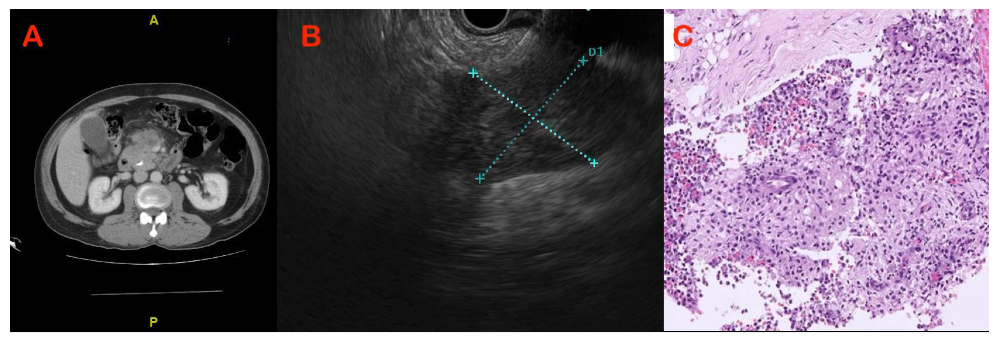 Diagnostics 13 01797 g002