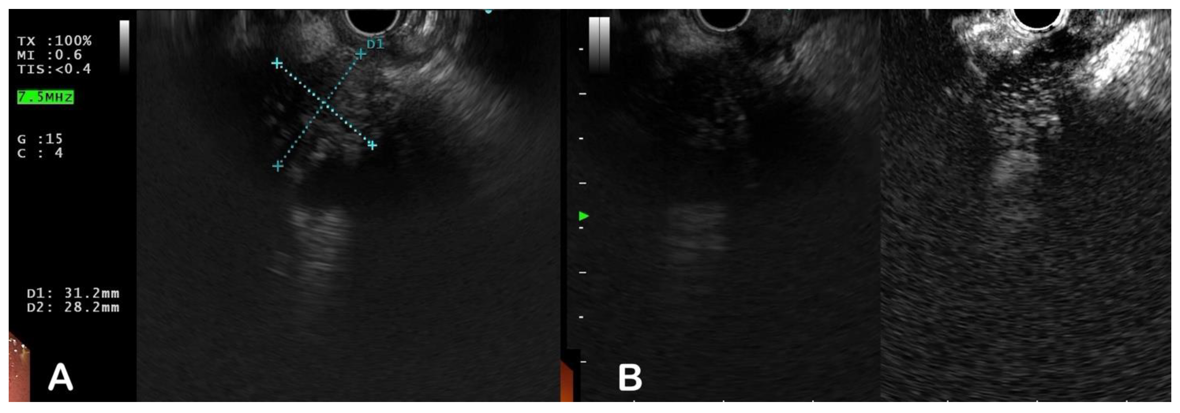 Diagnostics 13 01797 g003