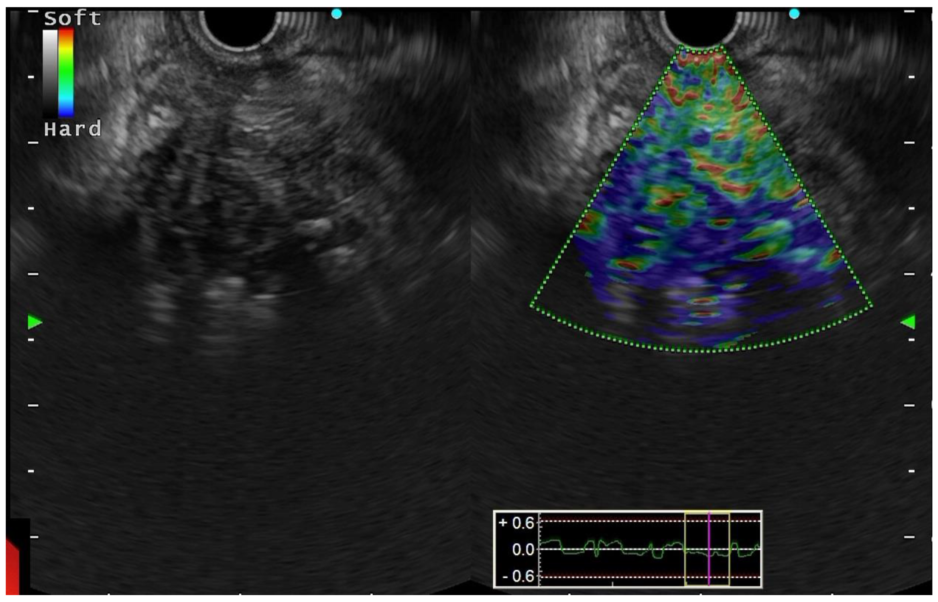 Diagnostics 13 01797 g004
