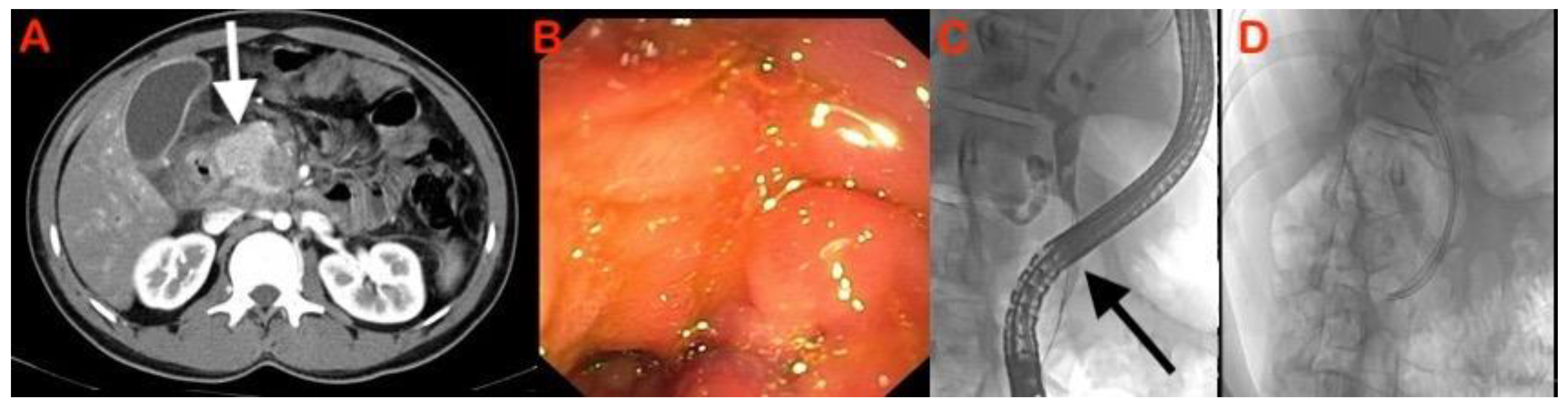 Diagnostics 13 01797 g005