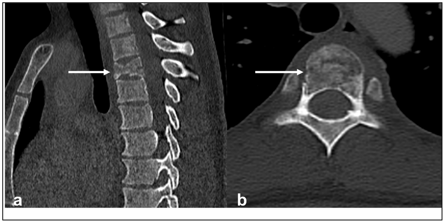 Diagnostics 13 01801 g001