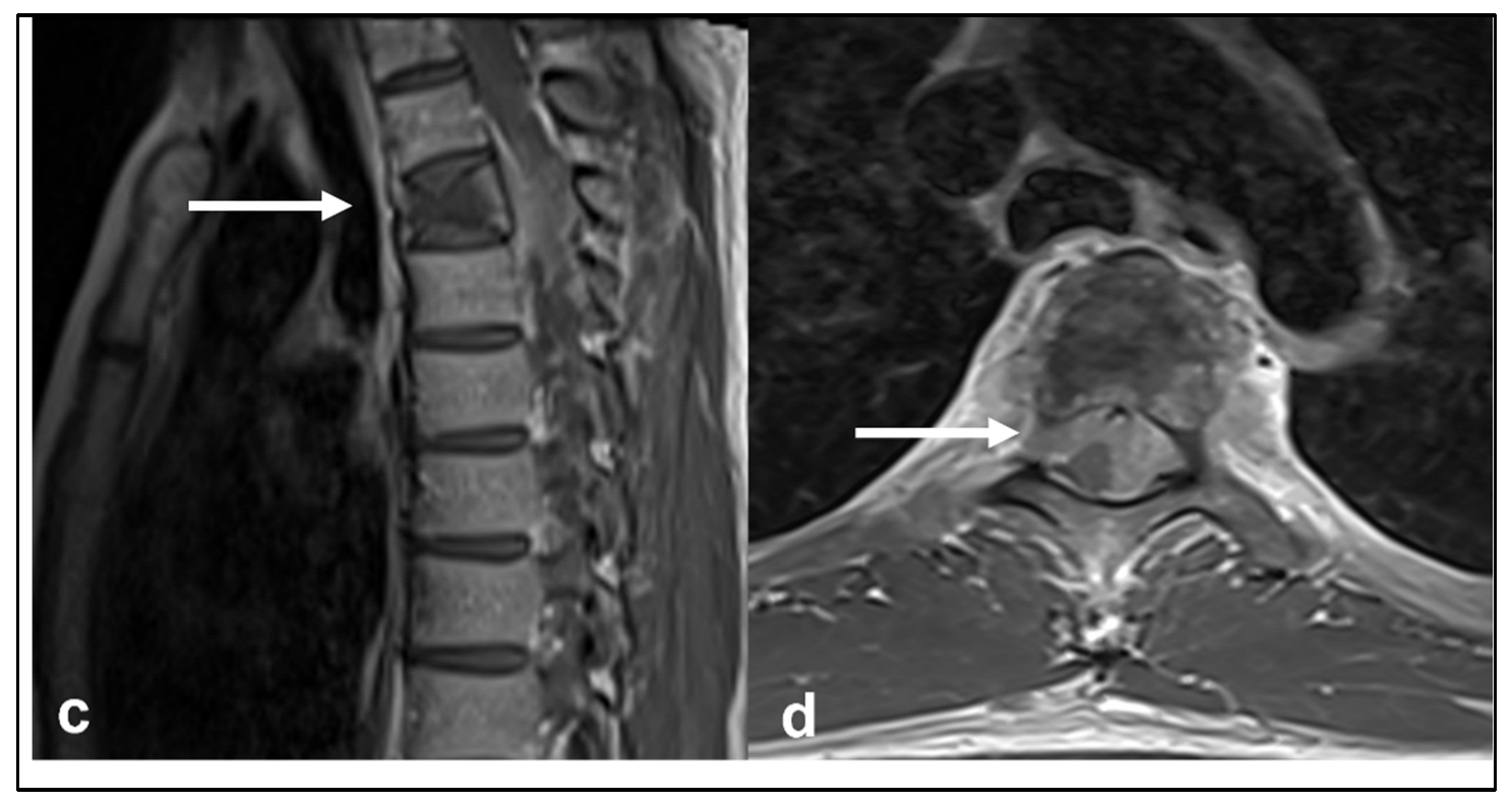 Diagnostics 13 01801 g002b