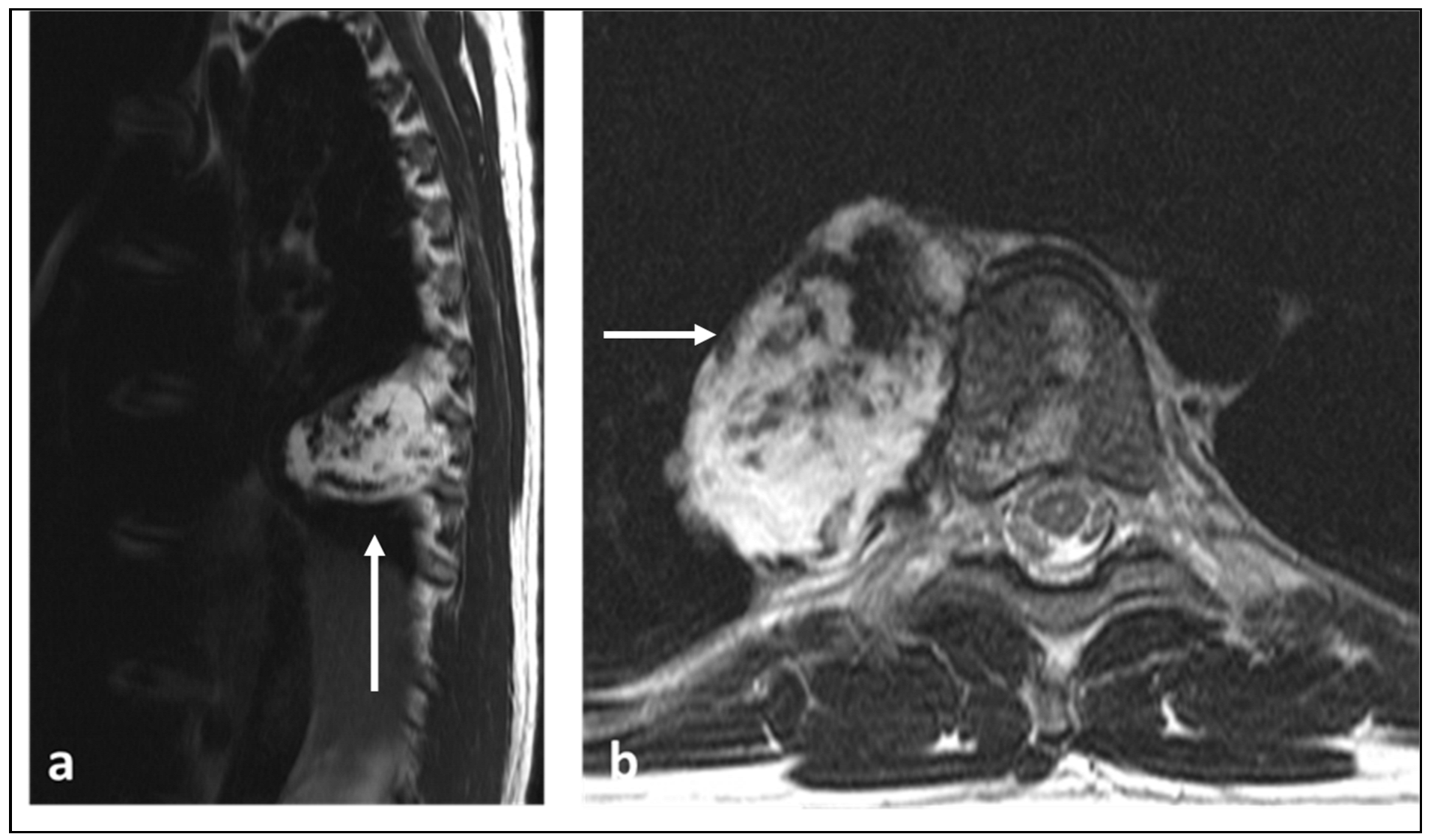 Diagnostics 13 01801 g005a