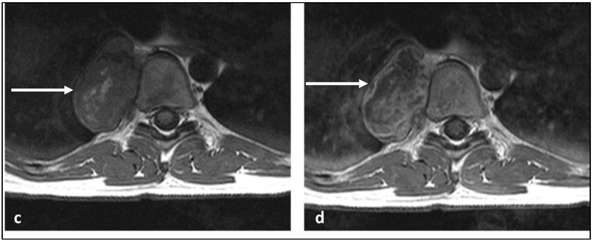 Diagnostics 13 01801 g005b