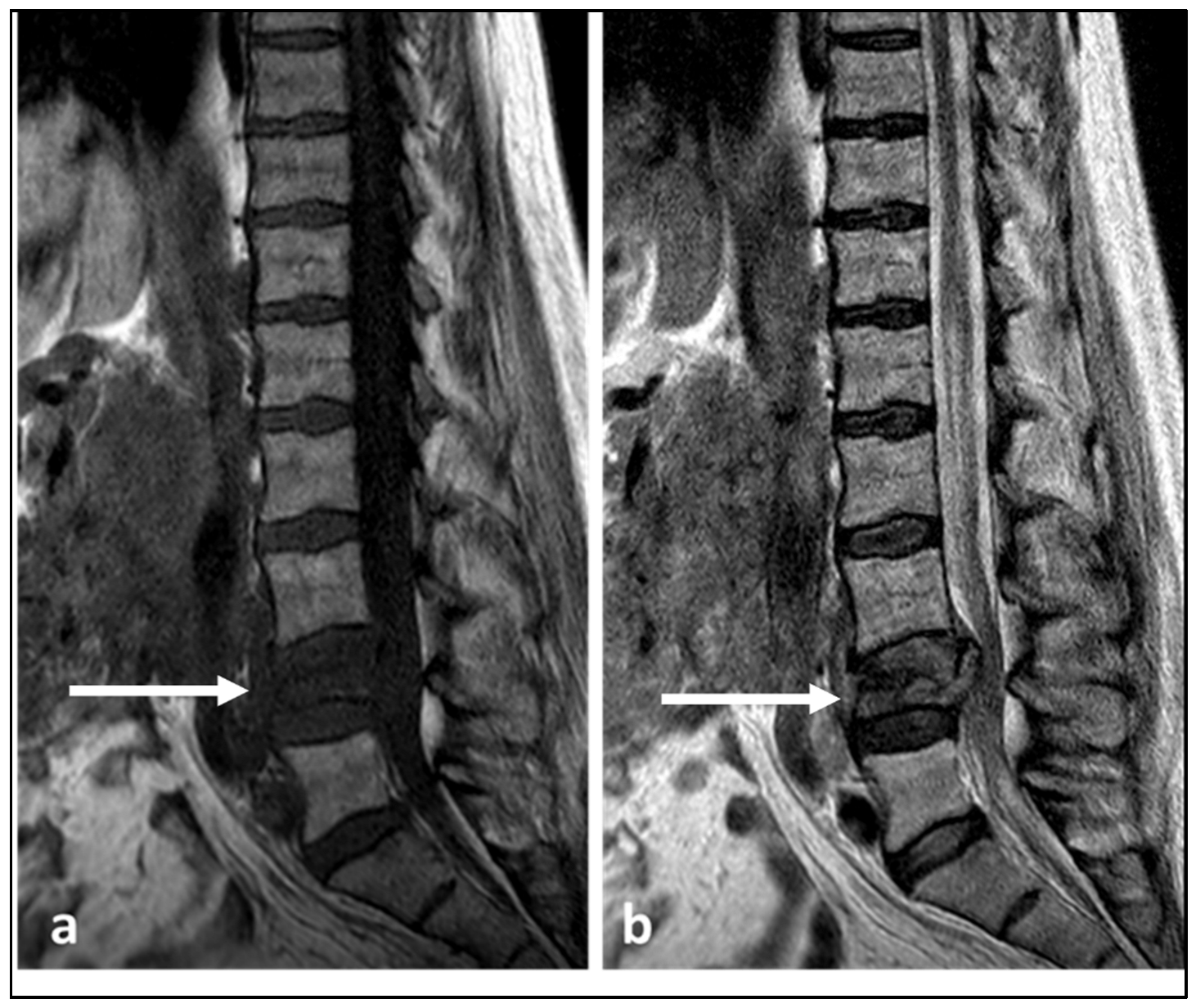 Diagnostics 13 01801 g008