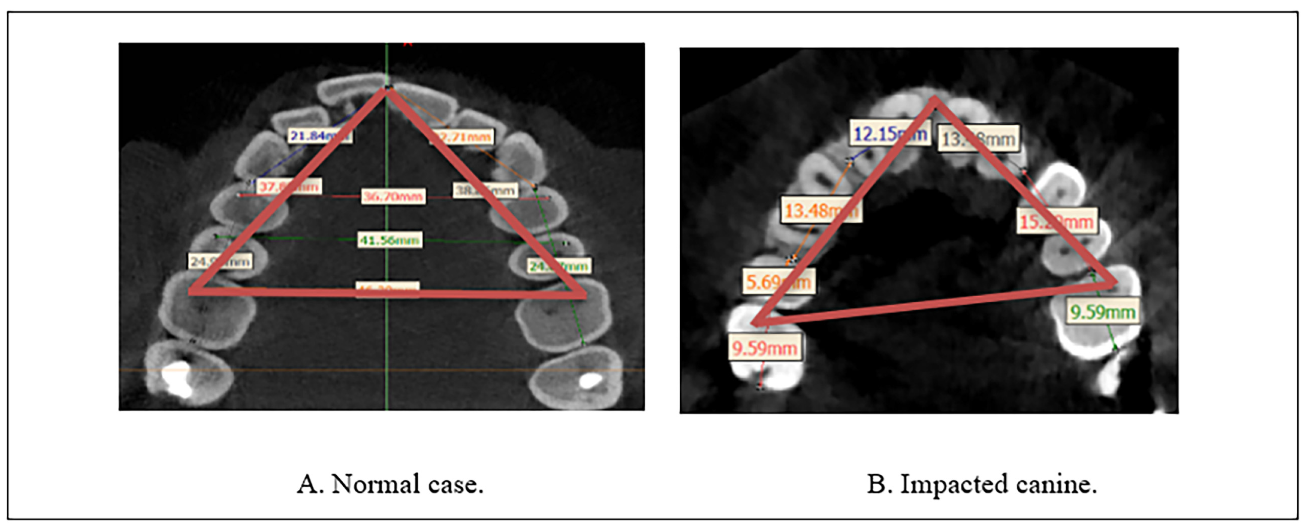 Diagnostics 13 01808 g002