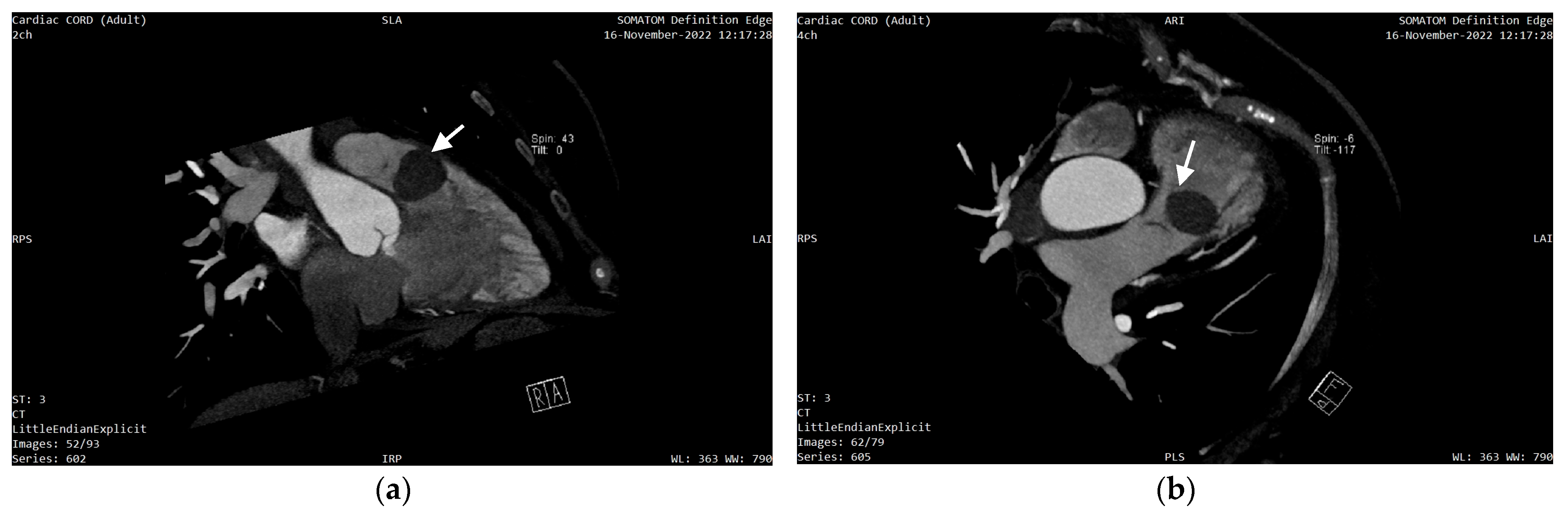 Diagnostics 13 01811 g005