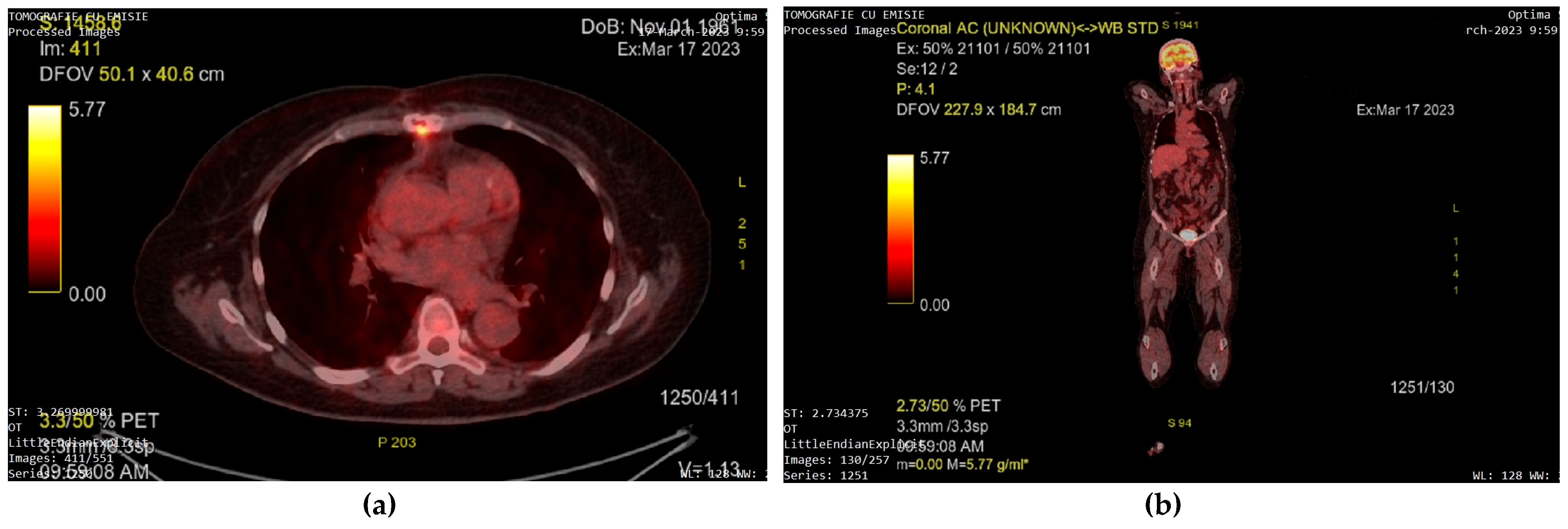 Diagnostics 13 01811 g008