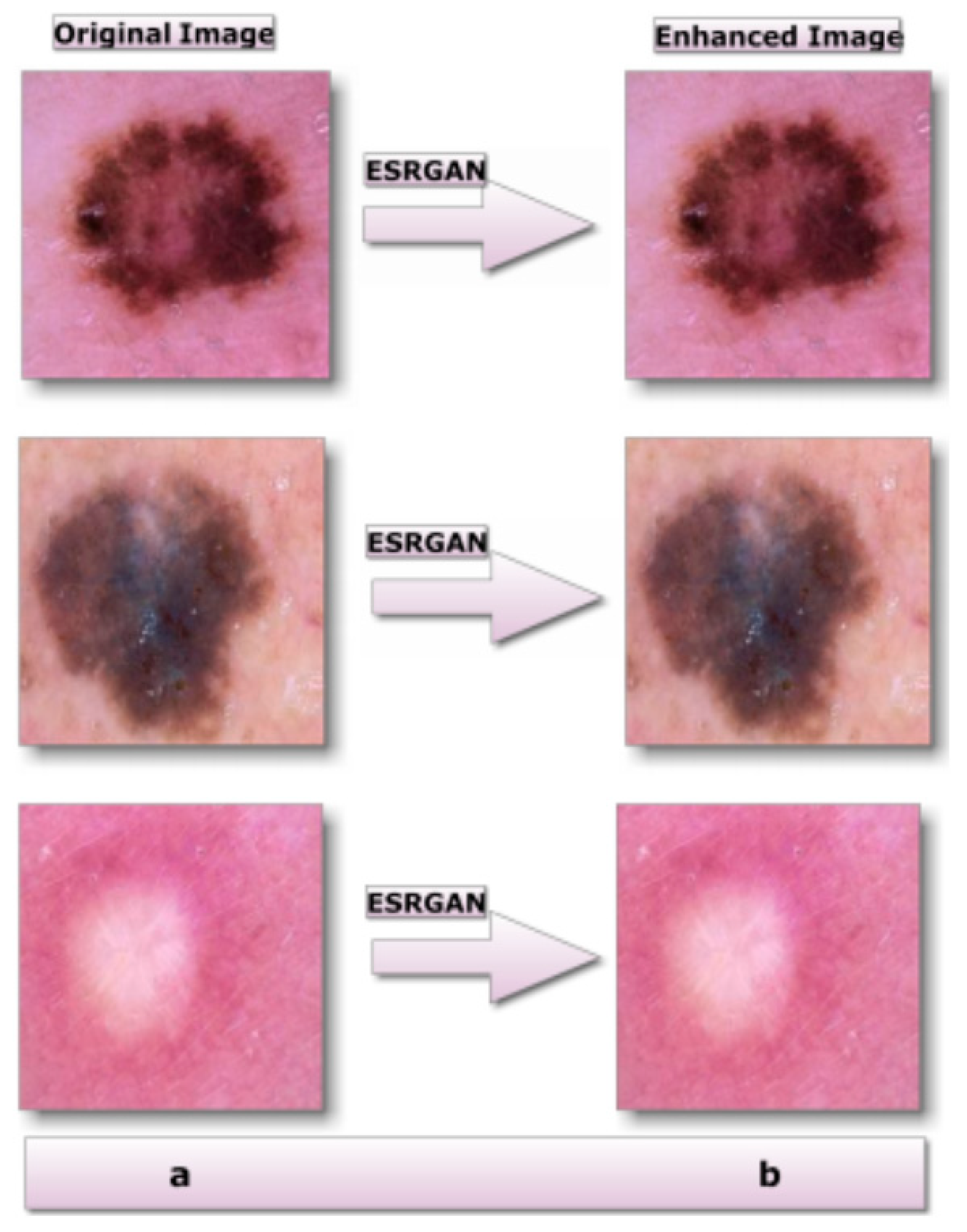 Diagnostics 13 01815 g004