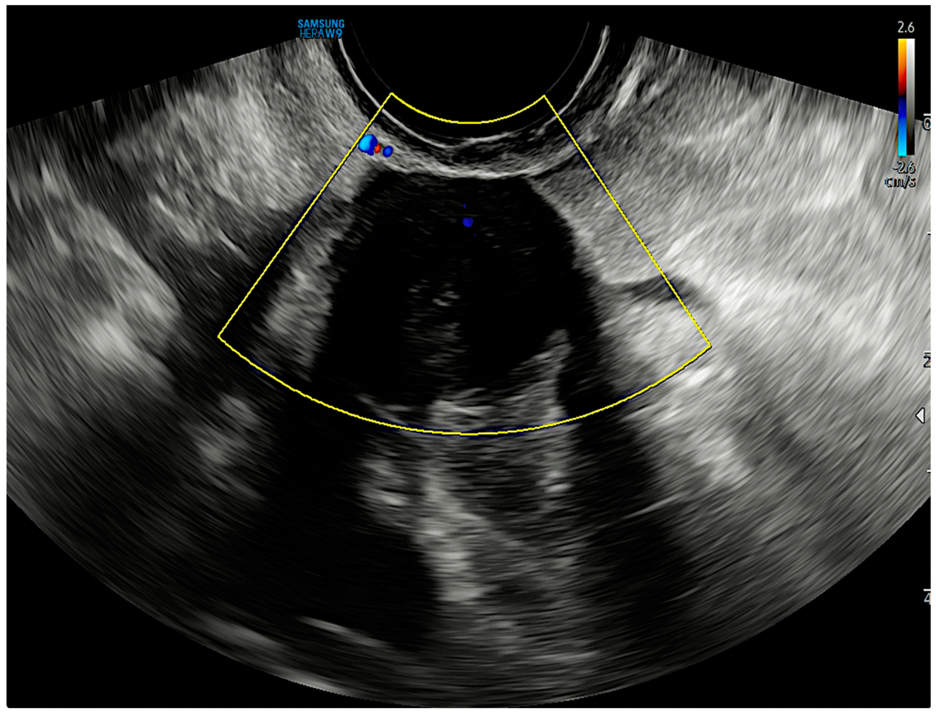 Diagnostics 13 01818 g002 Diagnostics 13 01818 g002