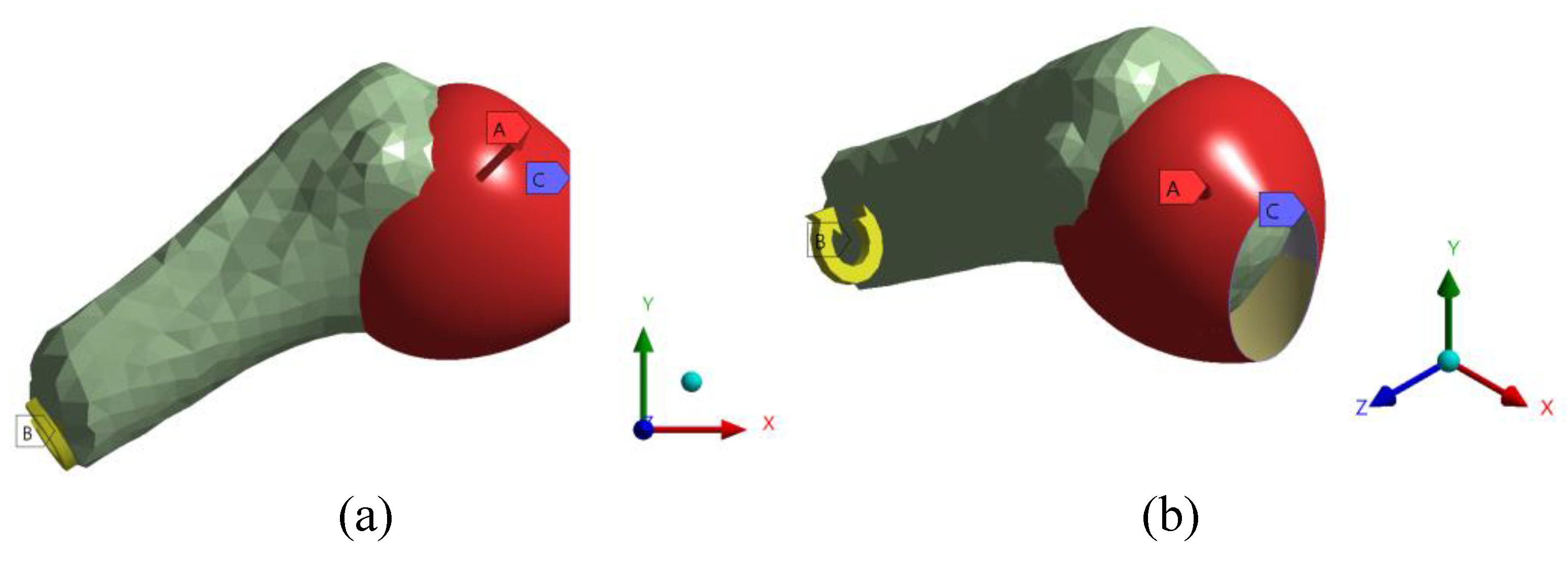 Diagnostics 13 01819 g005