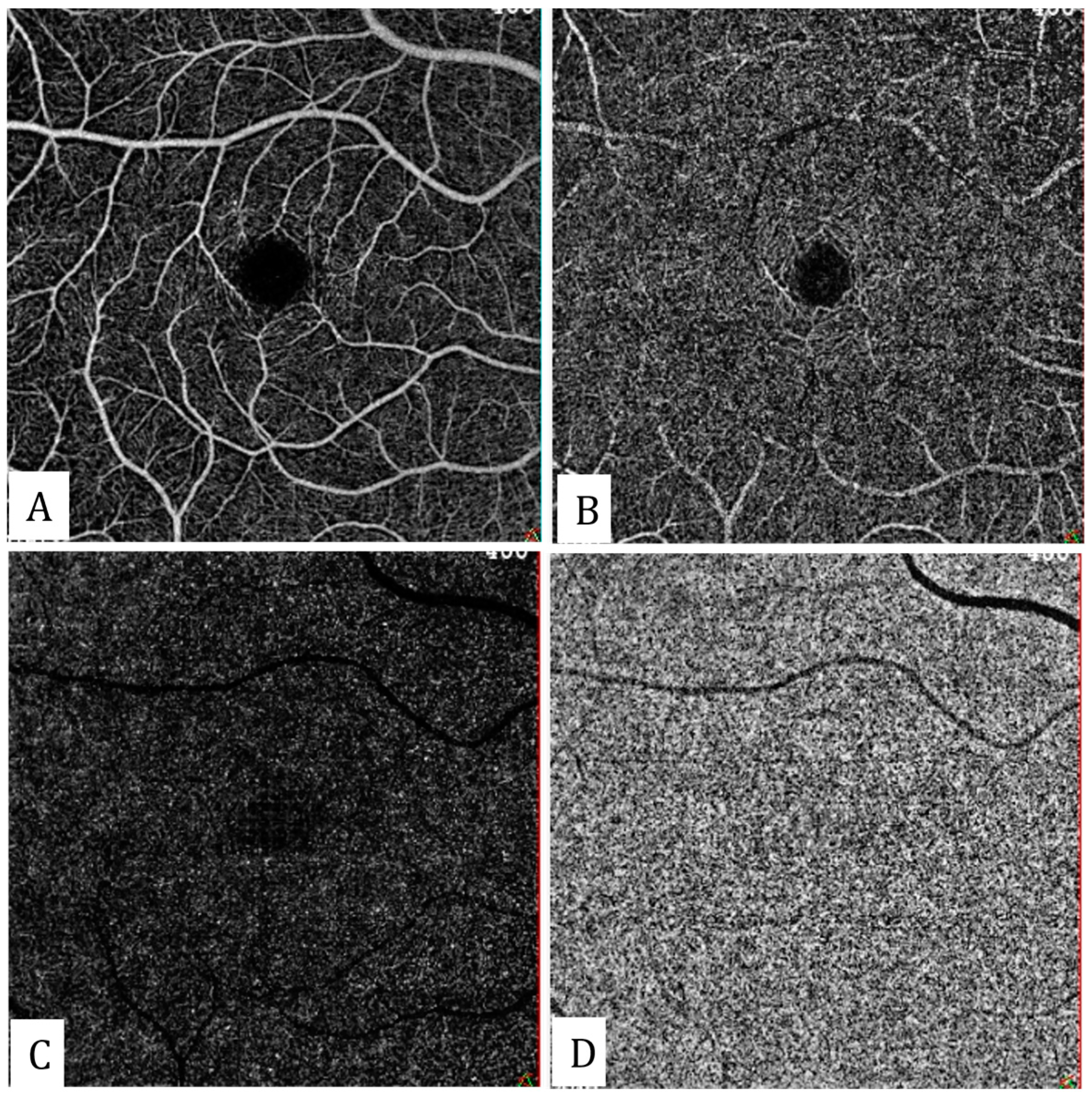 Diagnostics 13 01820 g001