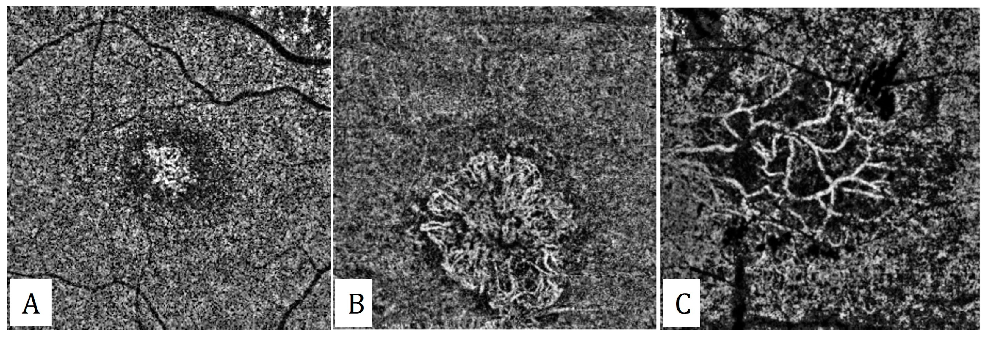 Diagnostics 13 01820 g002