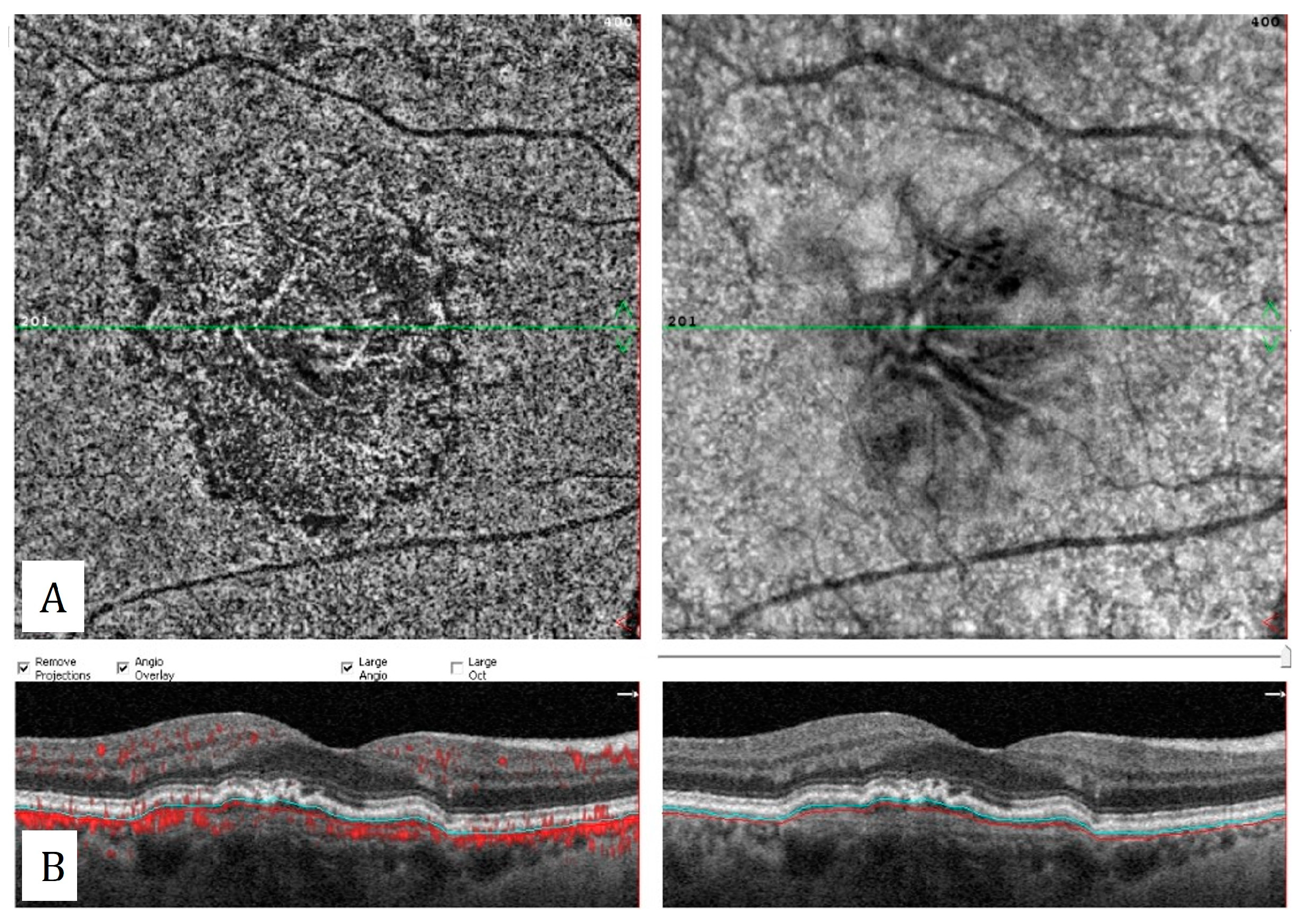 Diagnostics 13 01820 g003