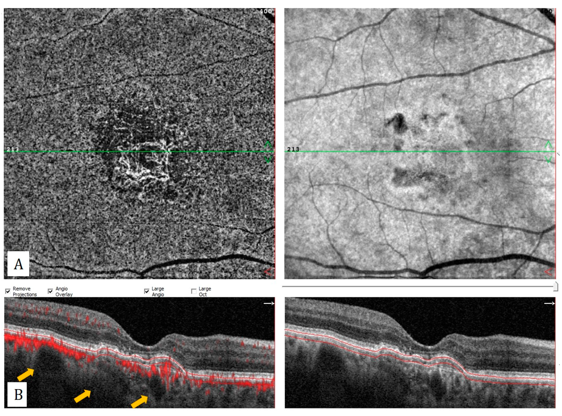 Diagnostics 13 01820 g005